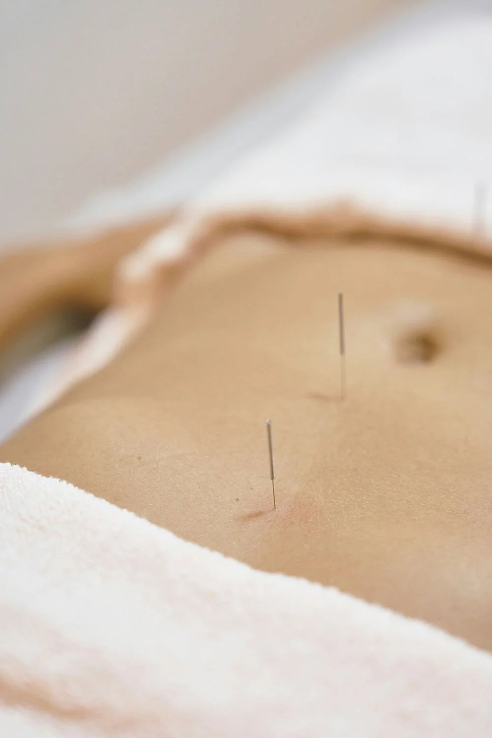 Acupuncture Autoimmune Respiratory Digestive