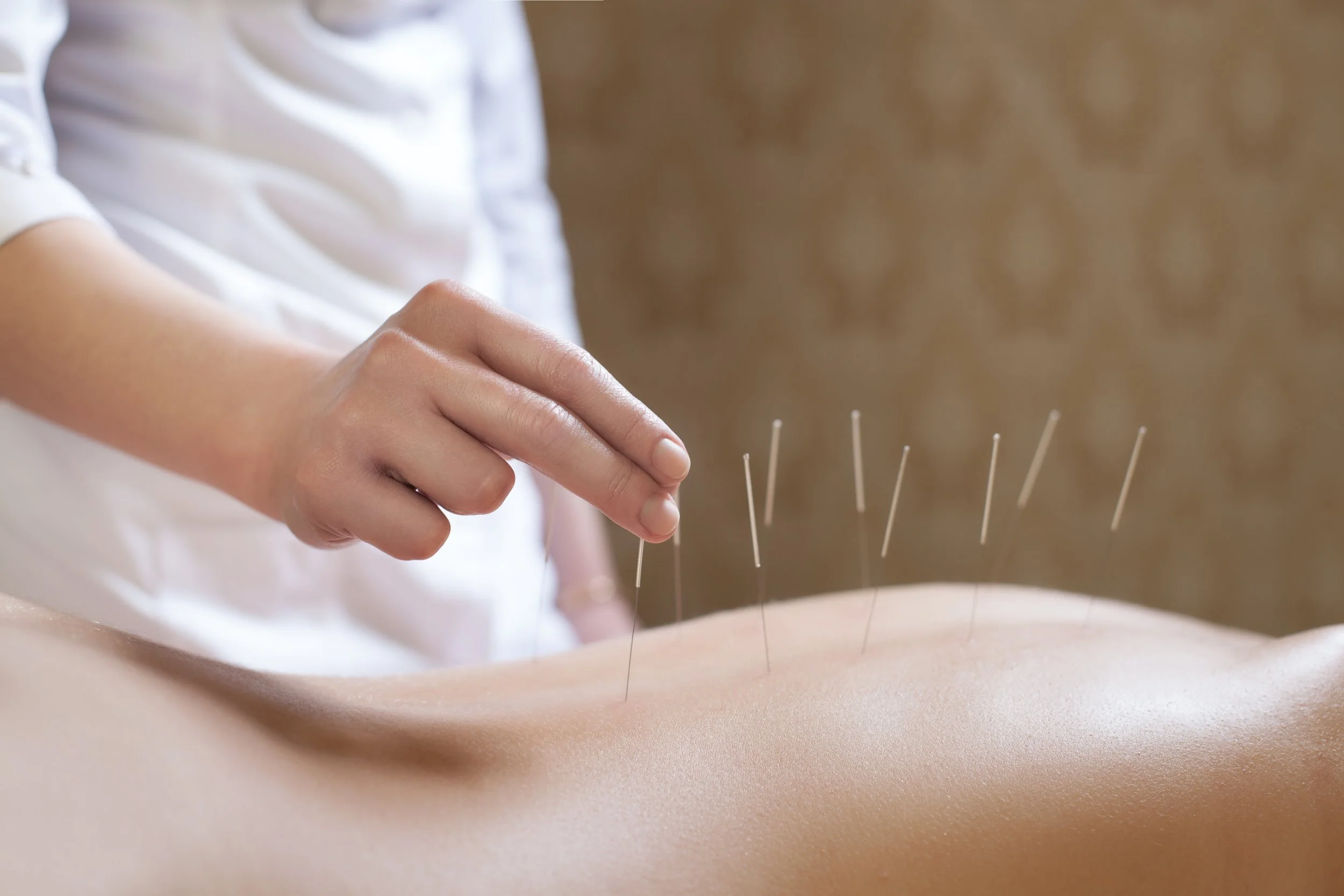 What Can Acupuncture Do