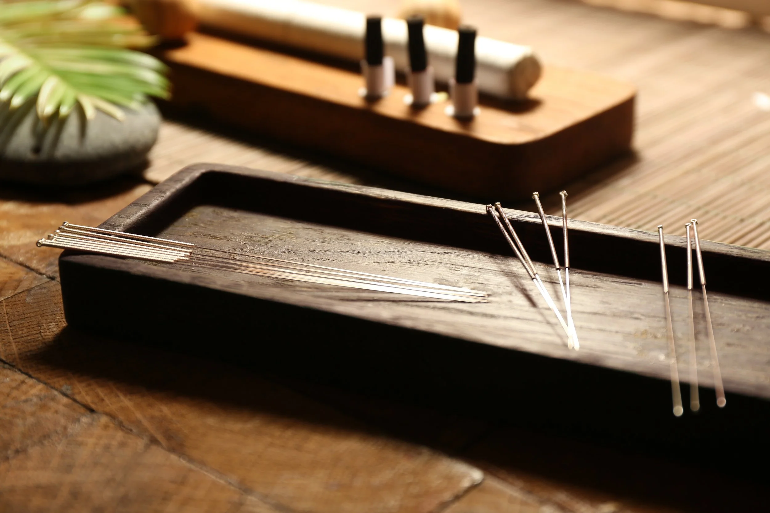 Acupuncture service