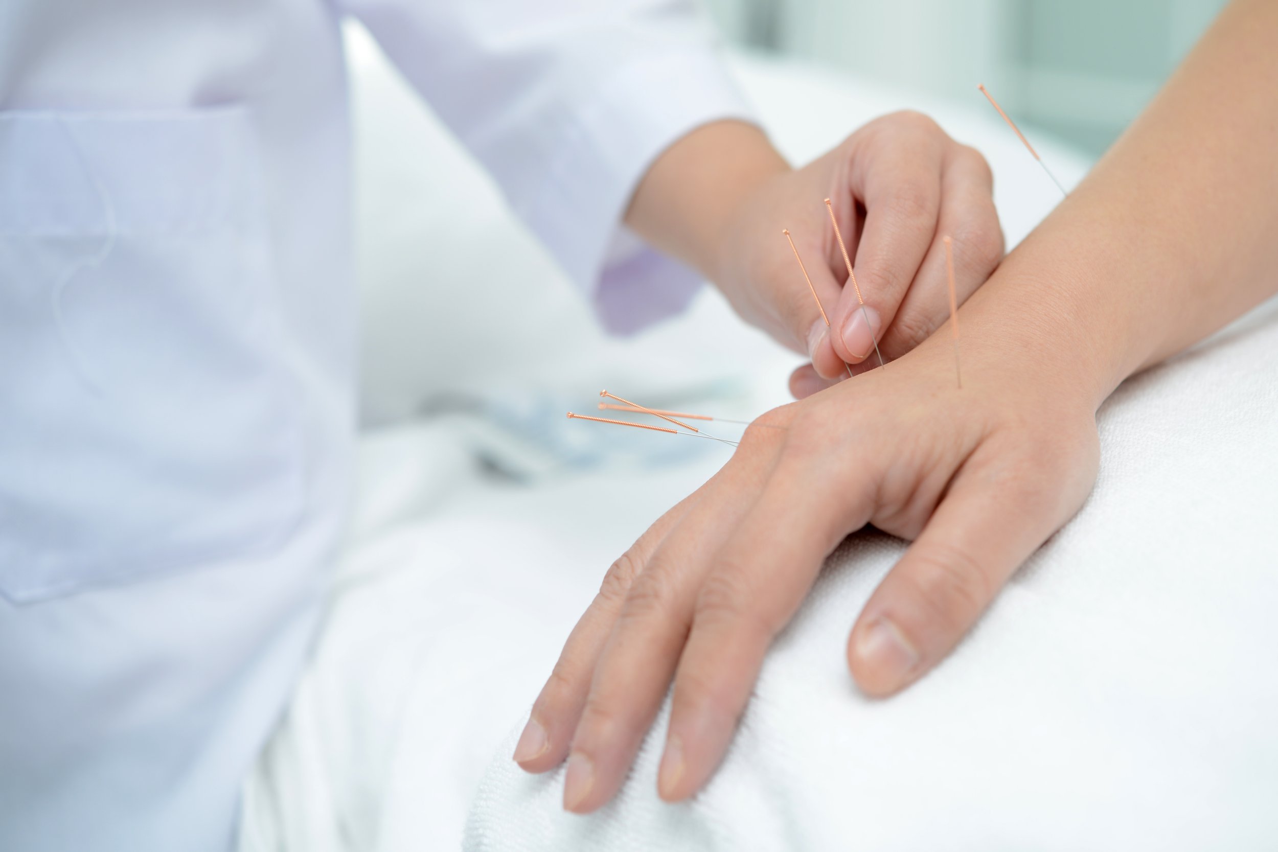Acupuncturist
