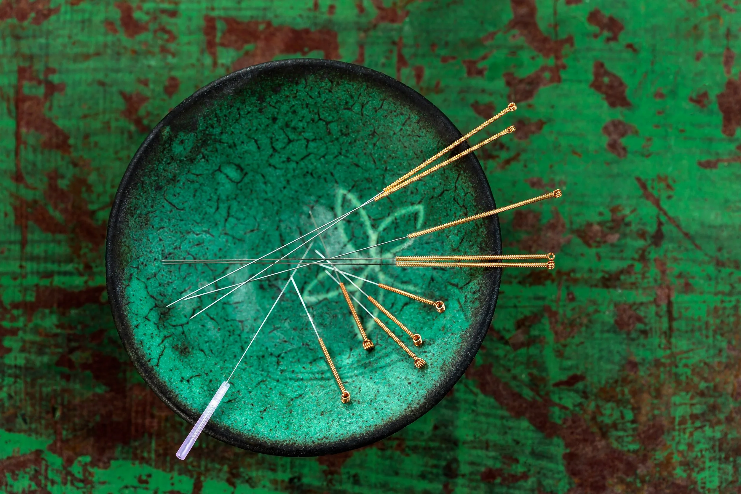 Acupuncture in Buckhead