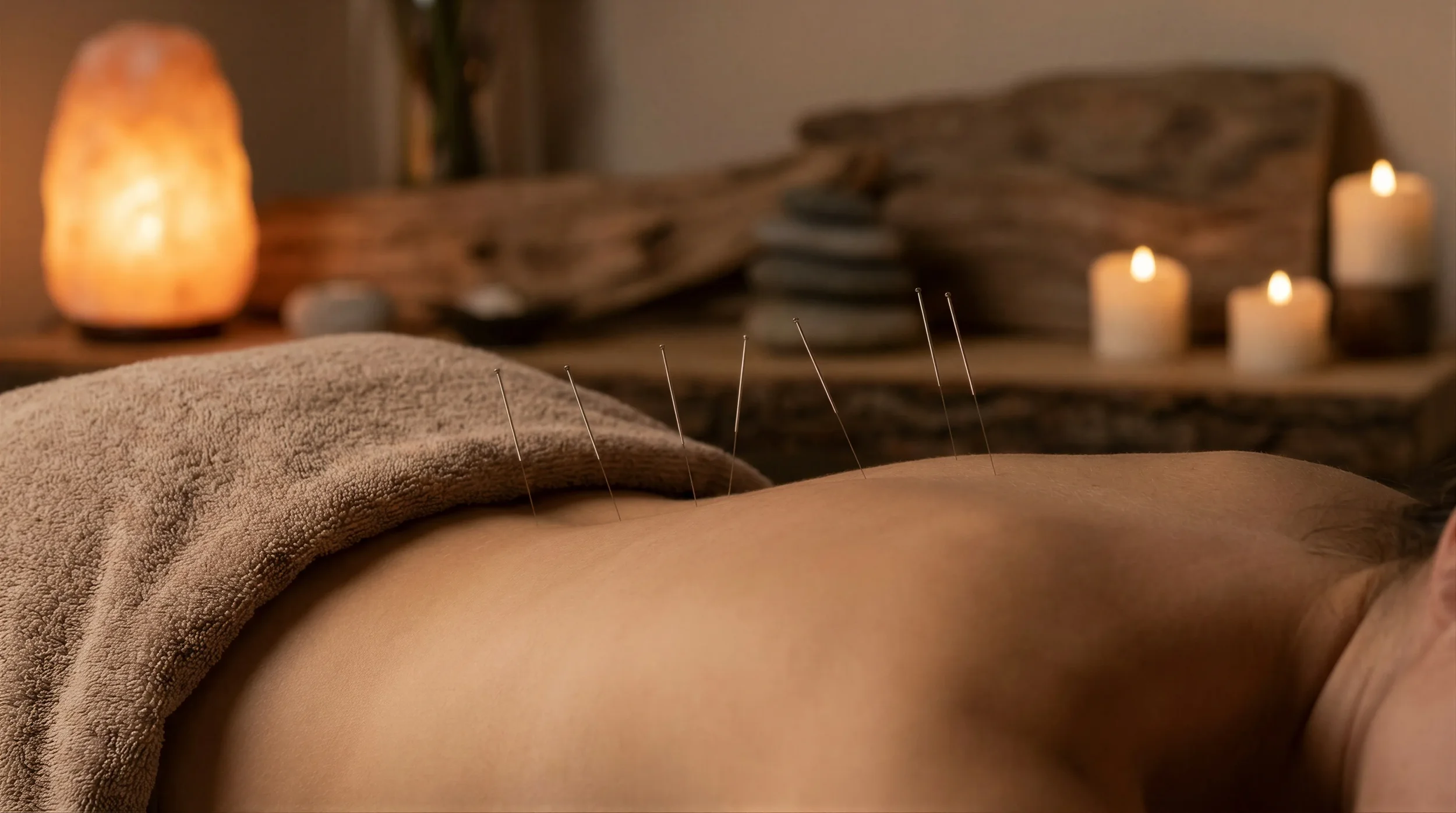Acupuncture for Back Pain