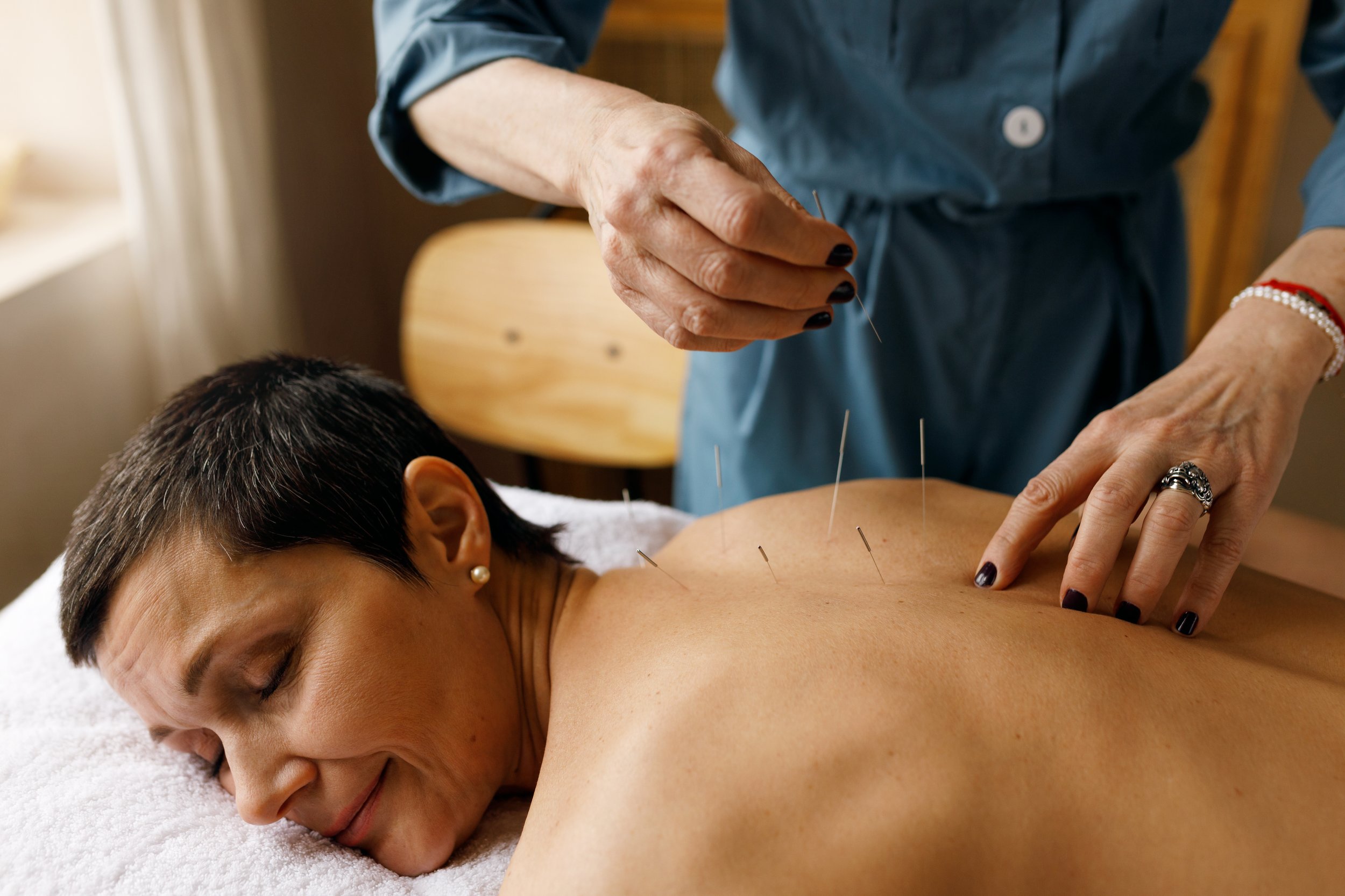 What Happens During Acupuncture