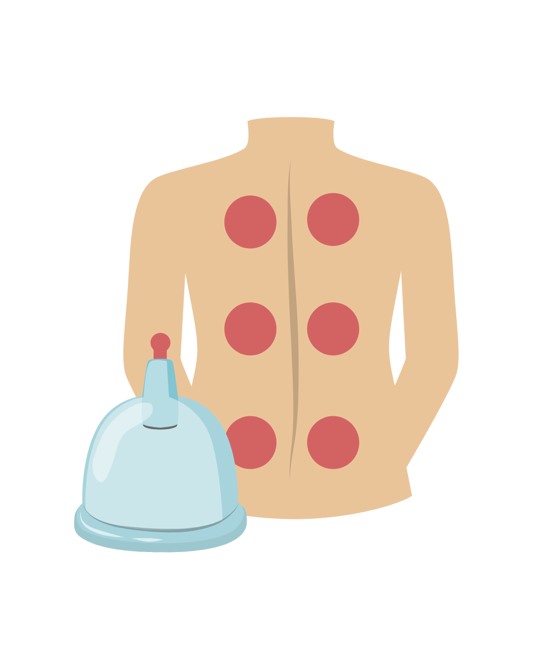 Silicone cups used during cupping therapy massage treatment