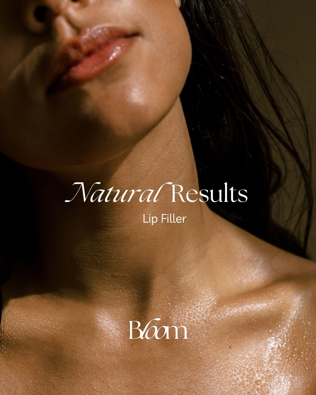 Natural Results Series: Lip Filler Edition 🤍

Lip filler&mdash;done the Bloom way.

We believe in subtle, undetectable enhancements that honor your natural anatomy, not override it. Think soft volume, improved hydration, and balanced shape&hellip; w