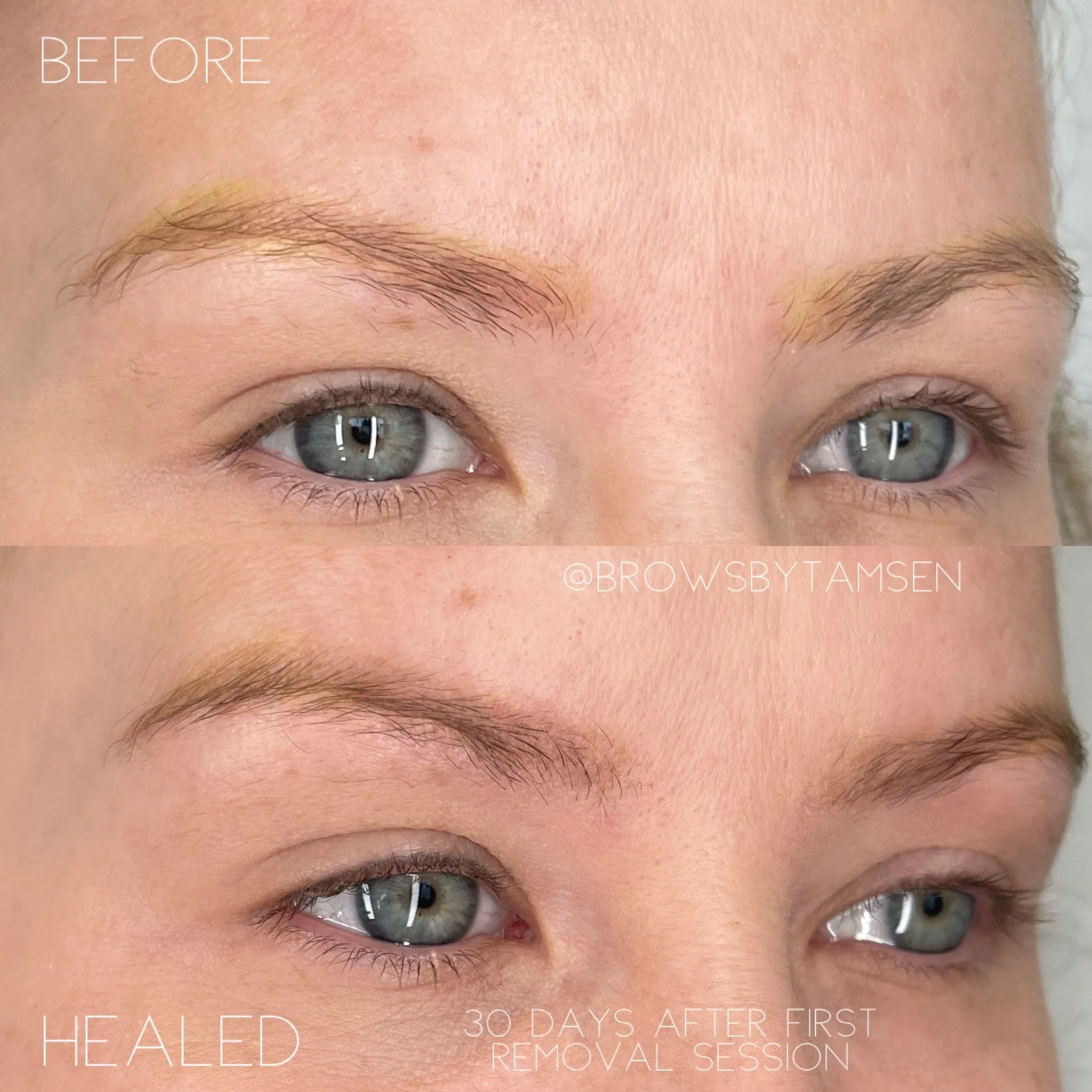 Comparison photo showing eyebrows before and after a 30-day healing process following eyebrow removal, with the top image labeled as 'BEFORE' and the bottom as 'HEALED 30 days after first removal session.'