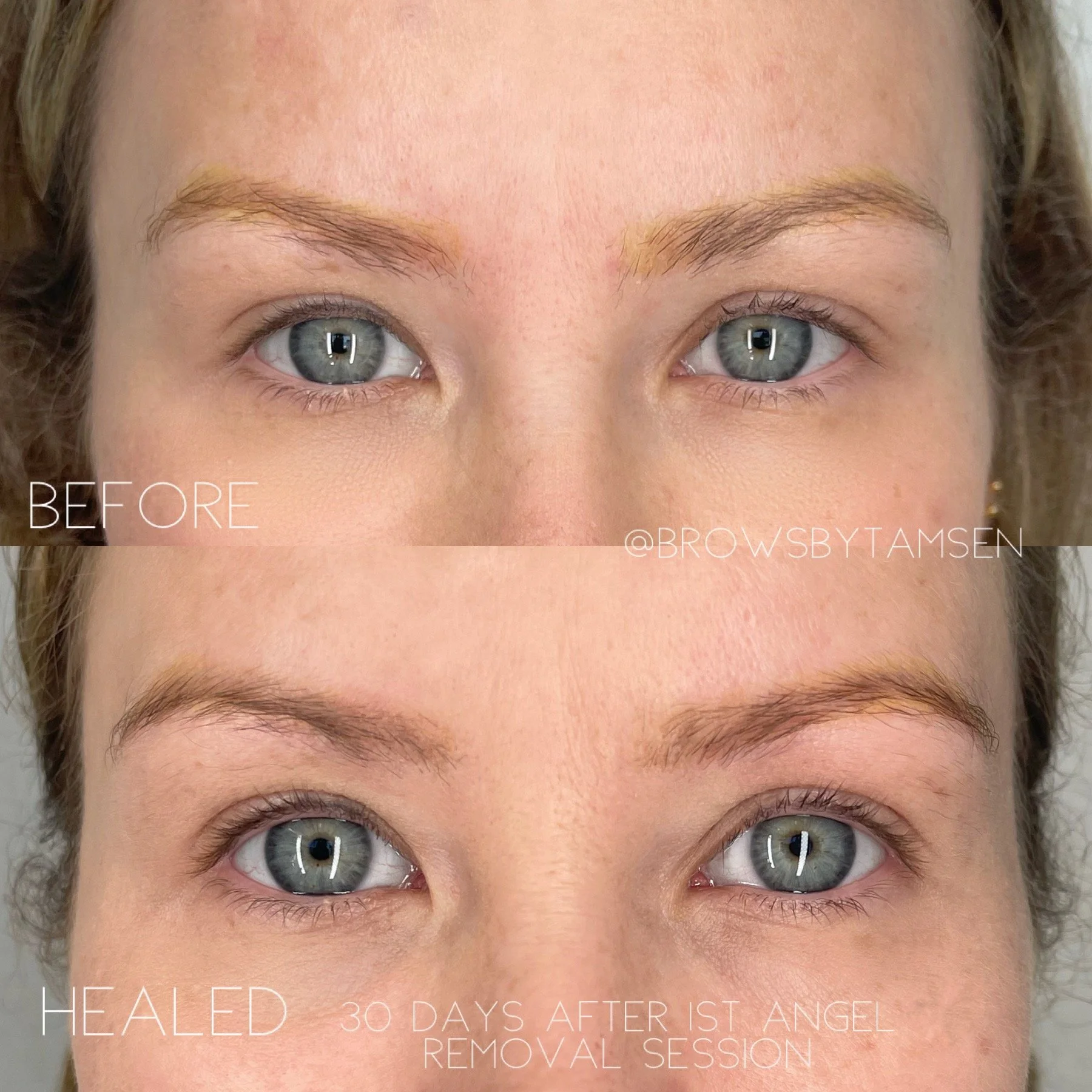 Comparison of a woman's eyebrows before and after a cosmetic treatment. The top image shows her natural eyebrows, while the bottom image shows the same eyebrows after 30 days post-treatment, appearing more full and shaped.