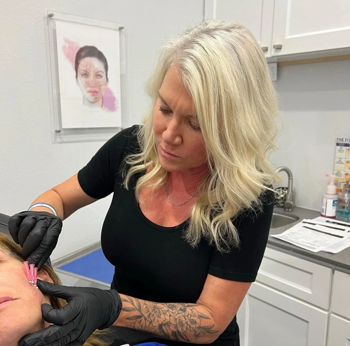 Woman performing cosmetic procedure with thread on a client's face in a clinic setting, wearing black gloves; background includes a facial anatomy illustration and medical supplies.