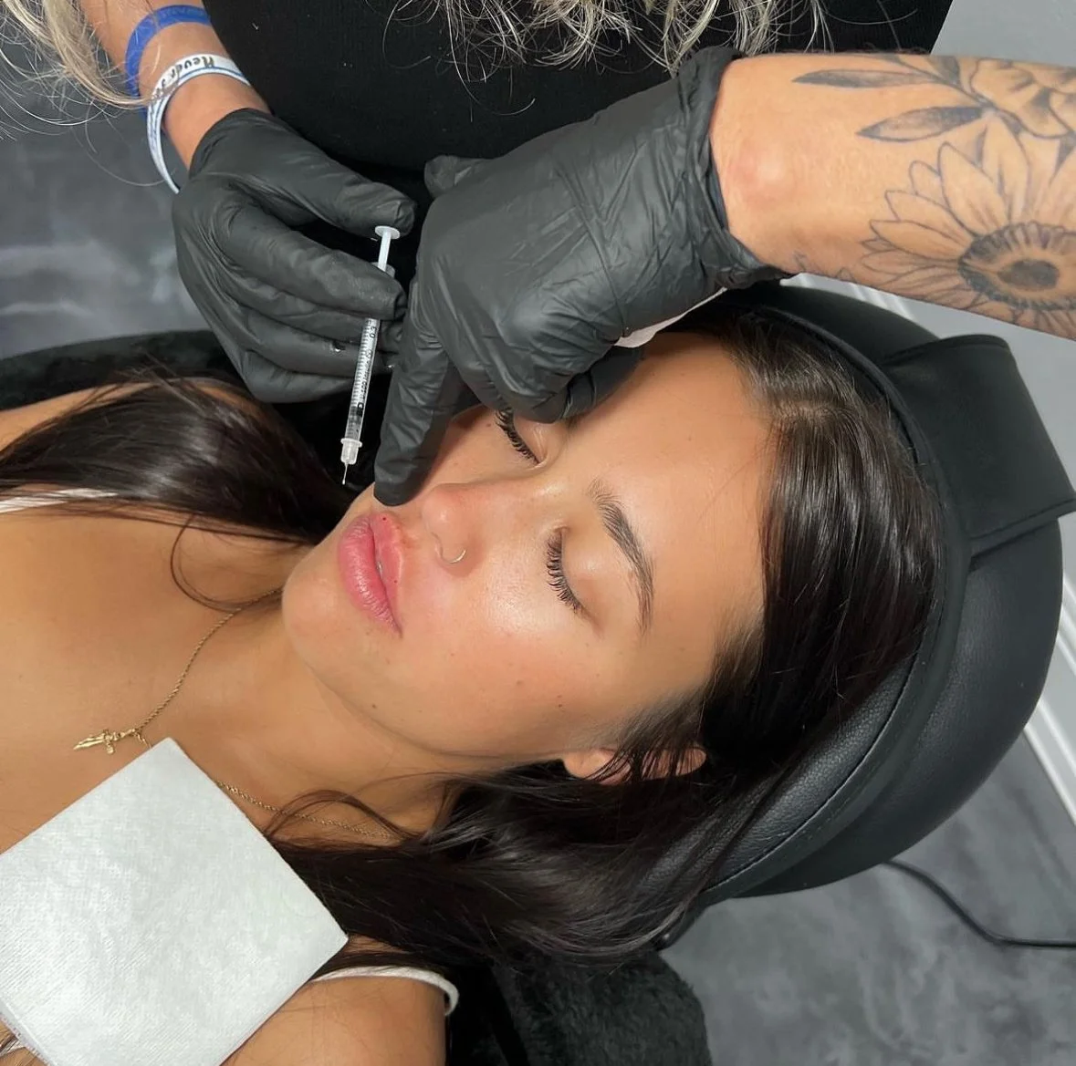 Person receiving cosmetic lip injection from a professional wearing black gloves.