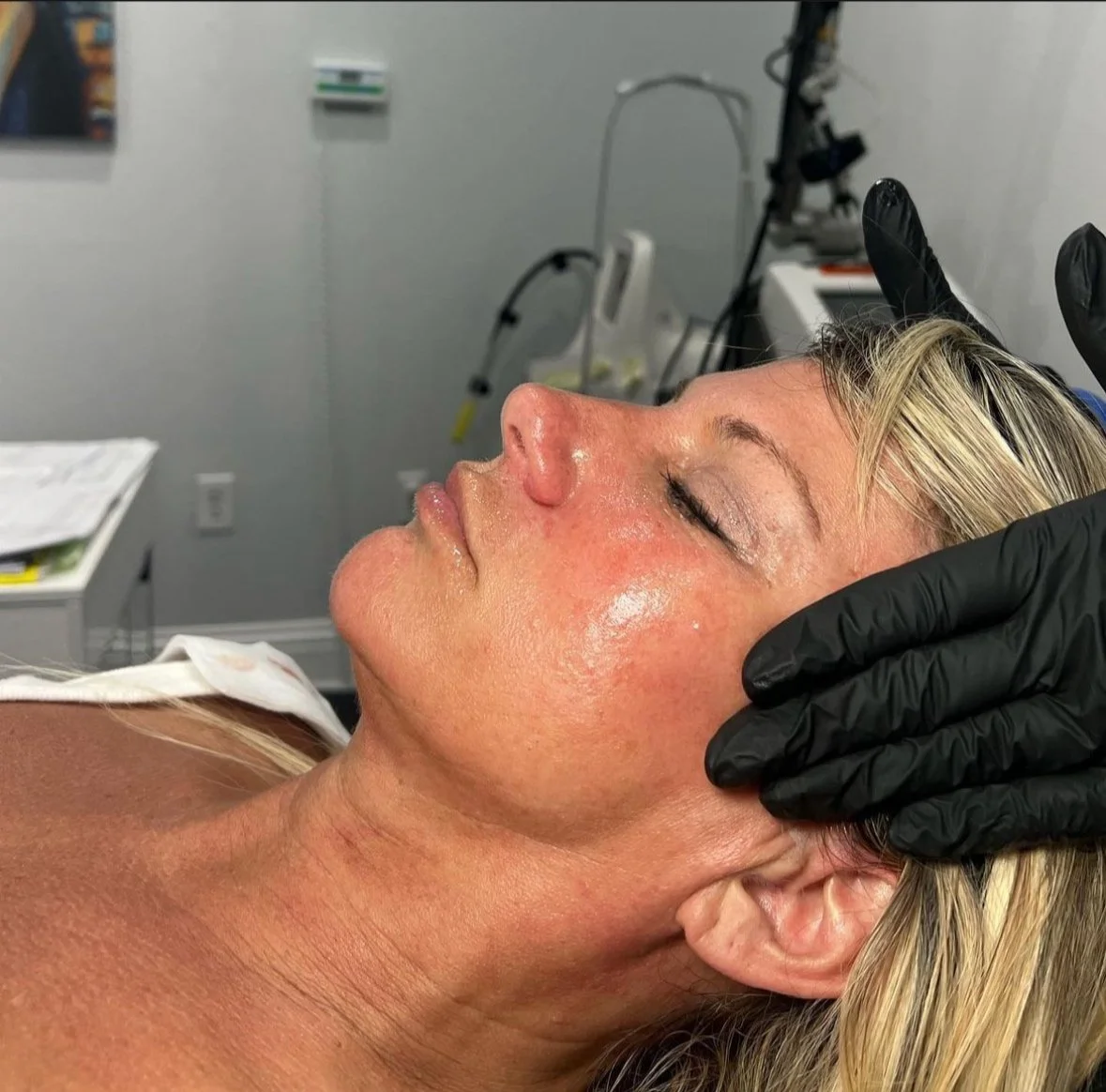 Person receiving facial treatment in a clinic, wearing black gloves.