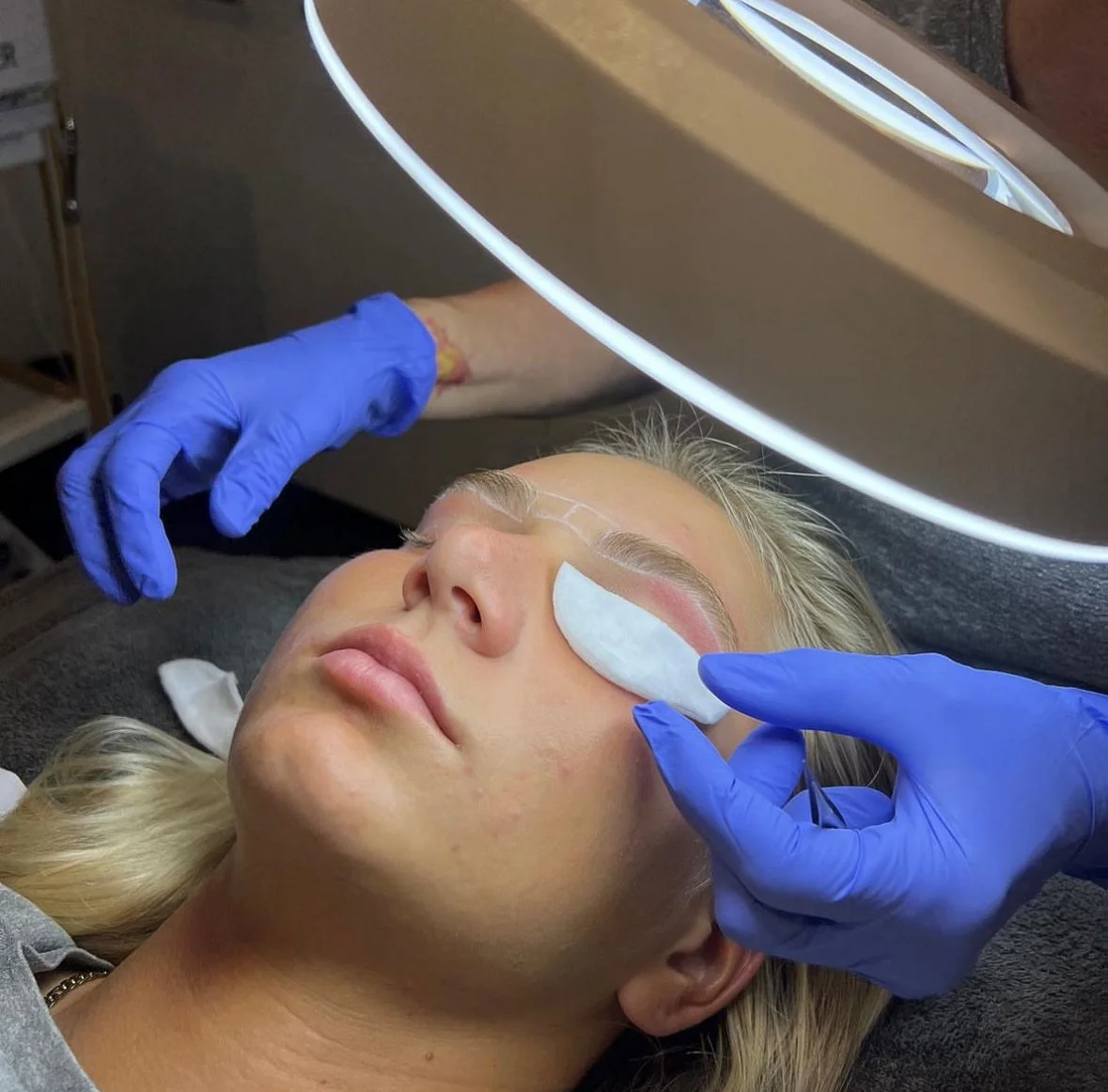 Close-up of a person receiving a beauty treatment with blue gloves placing an eye pad on their closed eyes under a bright lamp.
