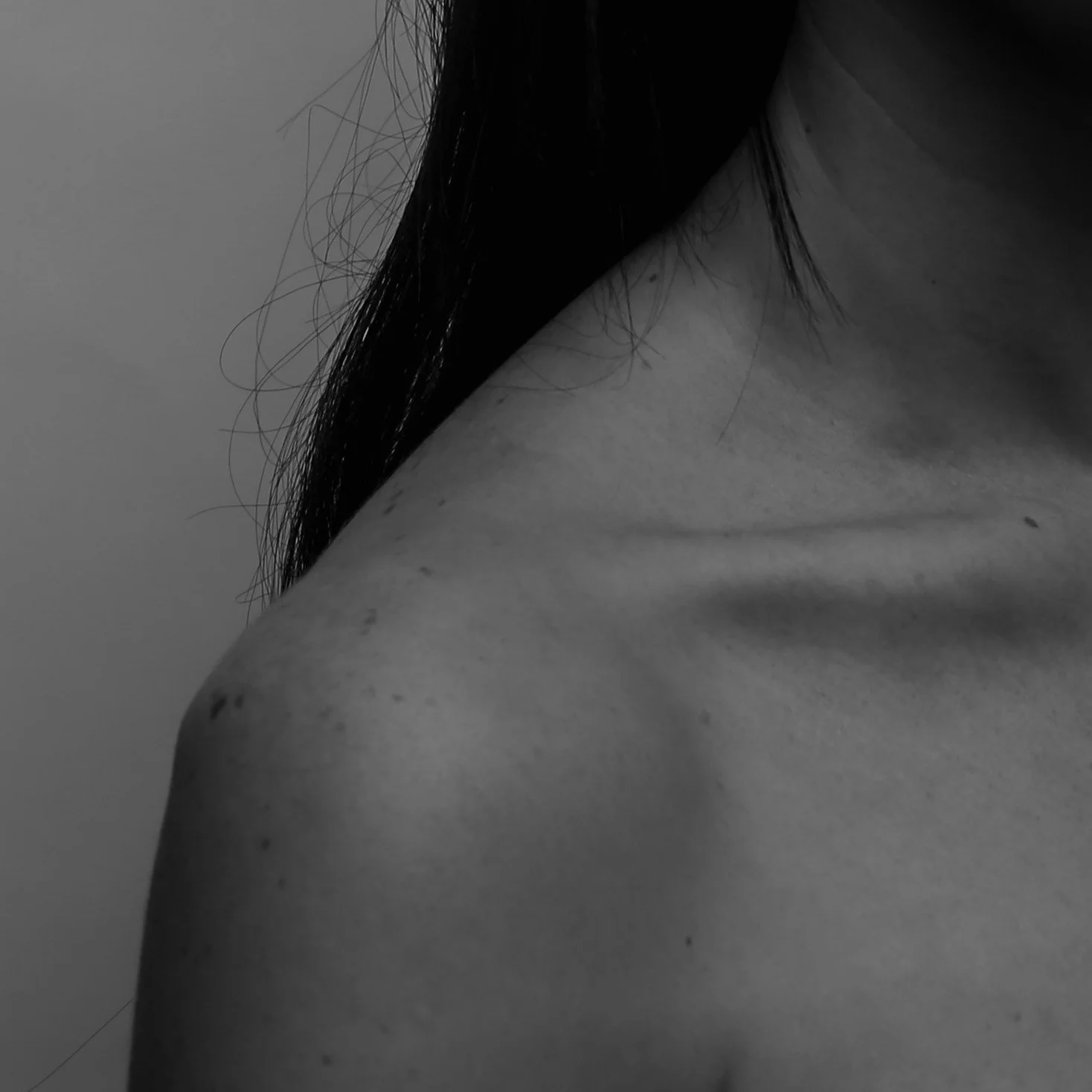 Skin-3.jpg