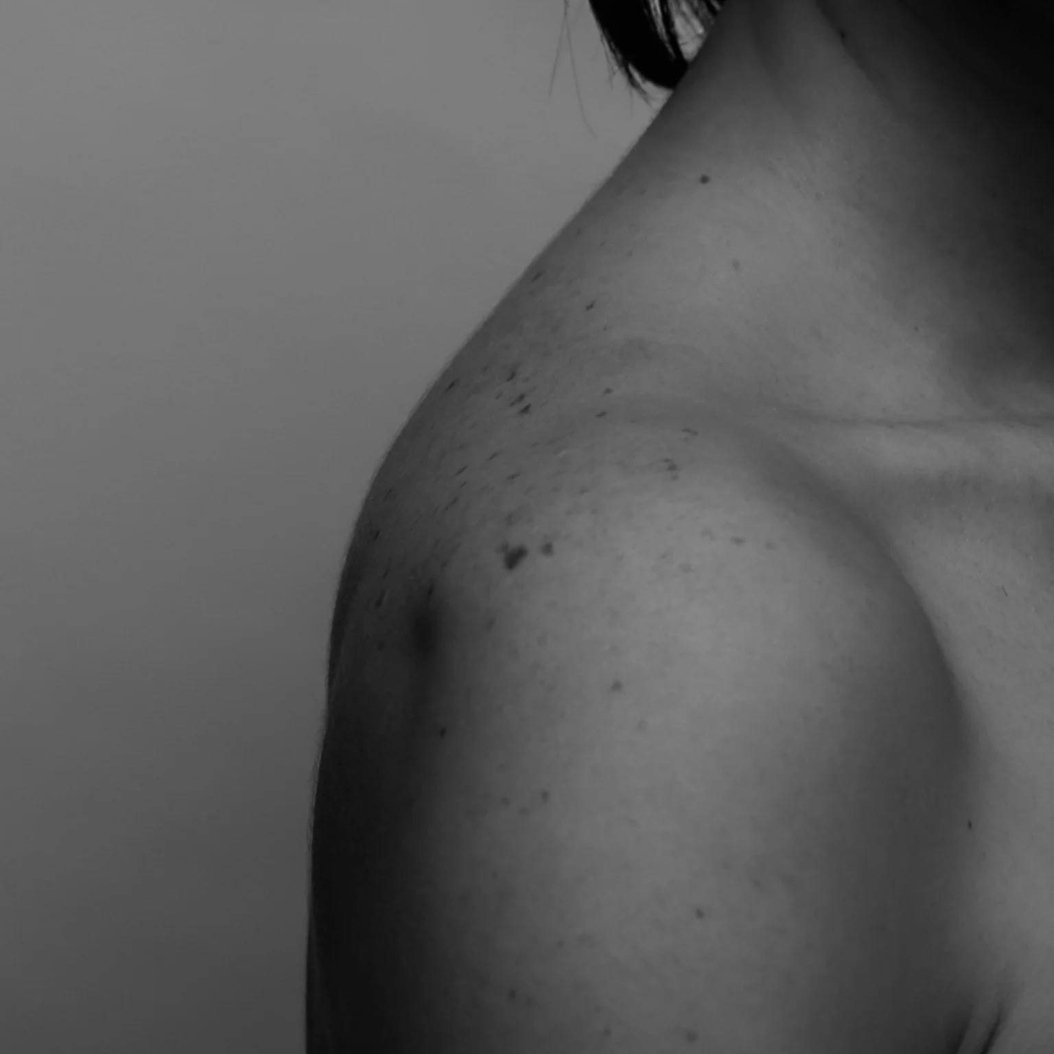 Skin-2.jpg