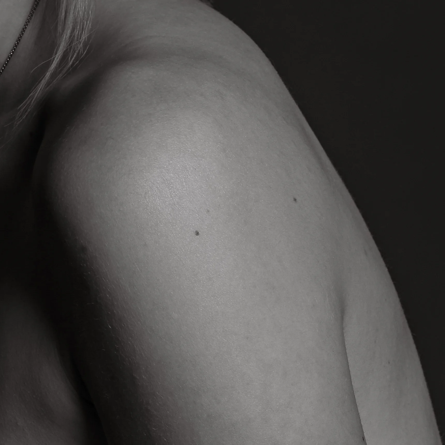 Skin-26.jpg