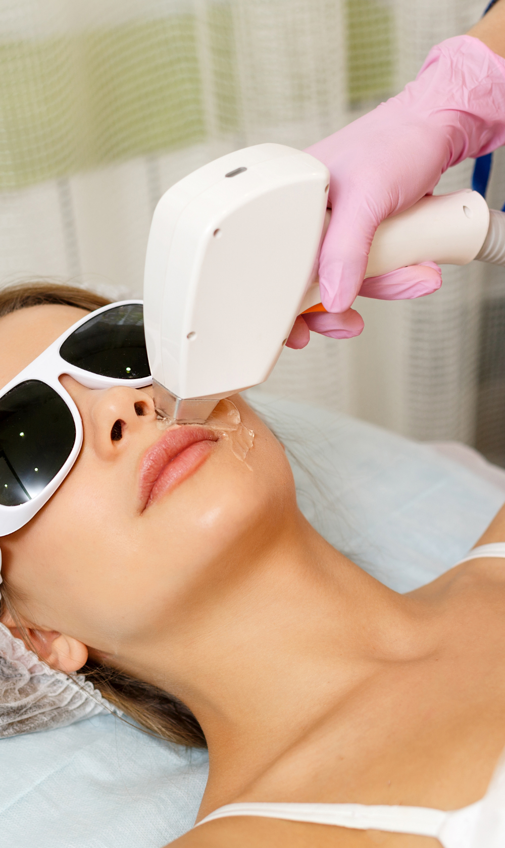 MOXI® LASER TREATMENT
