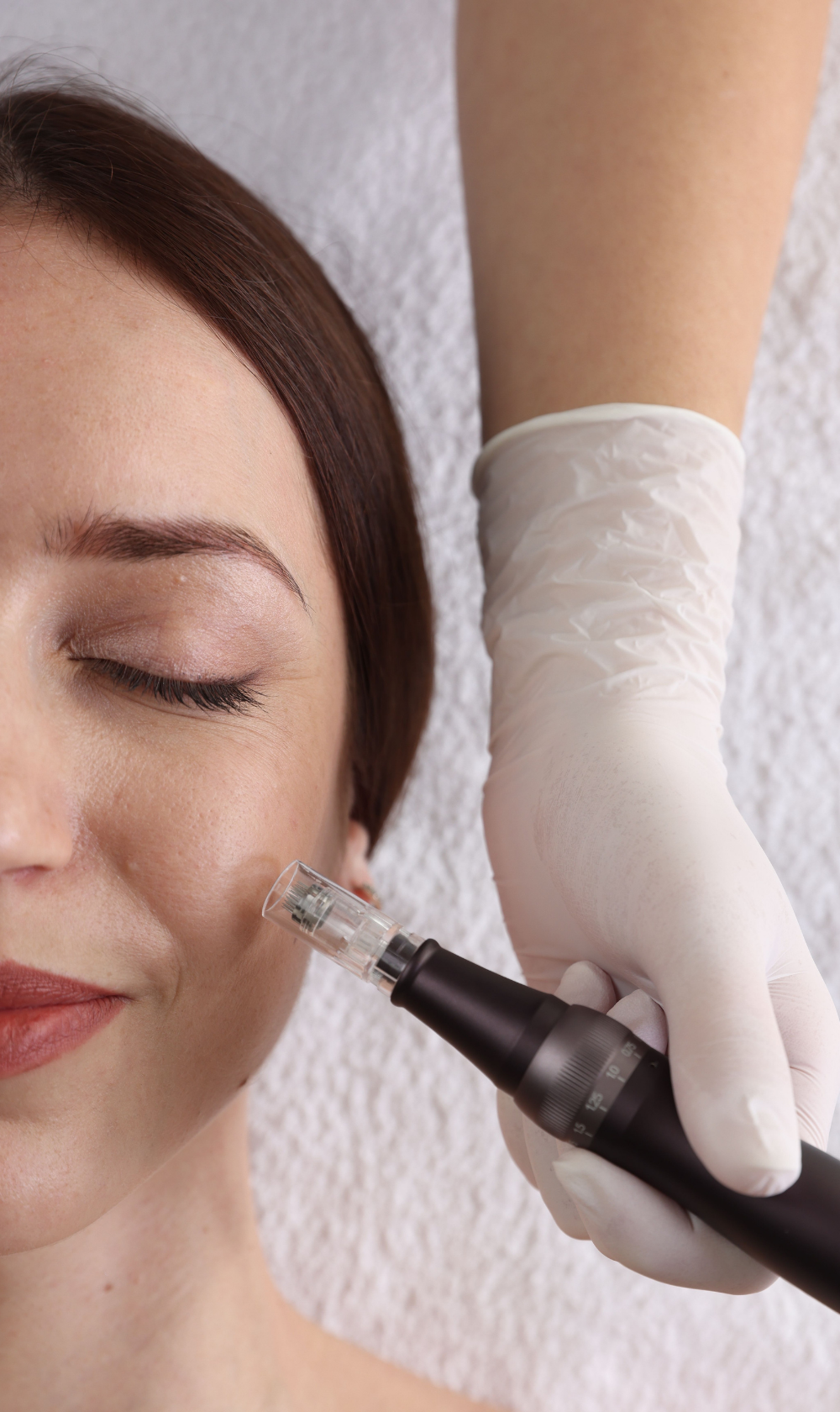 Microneedling