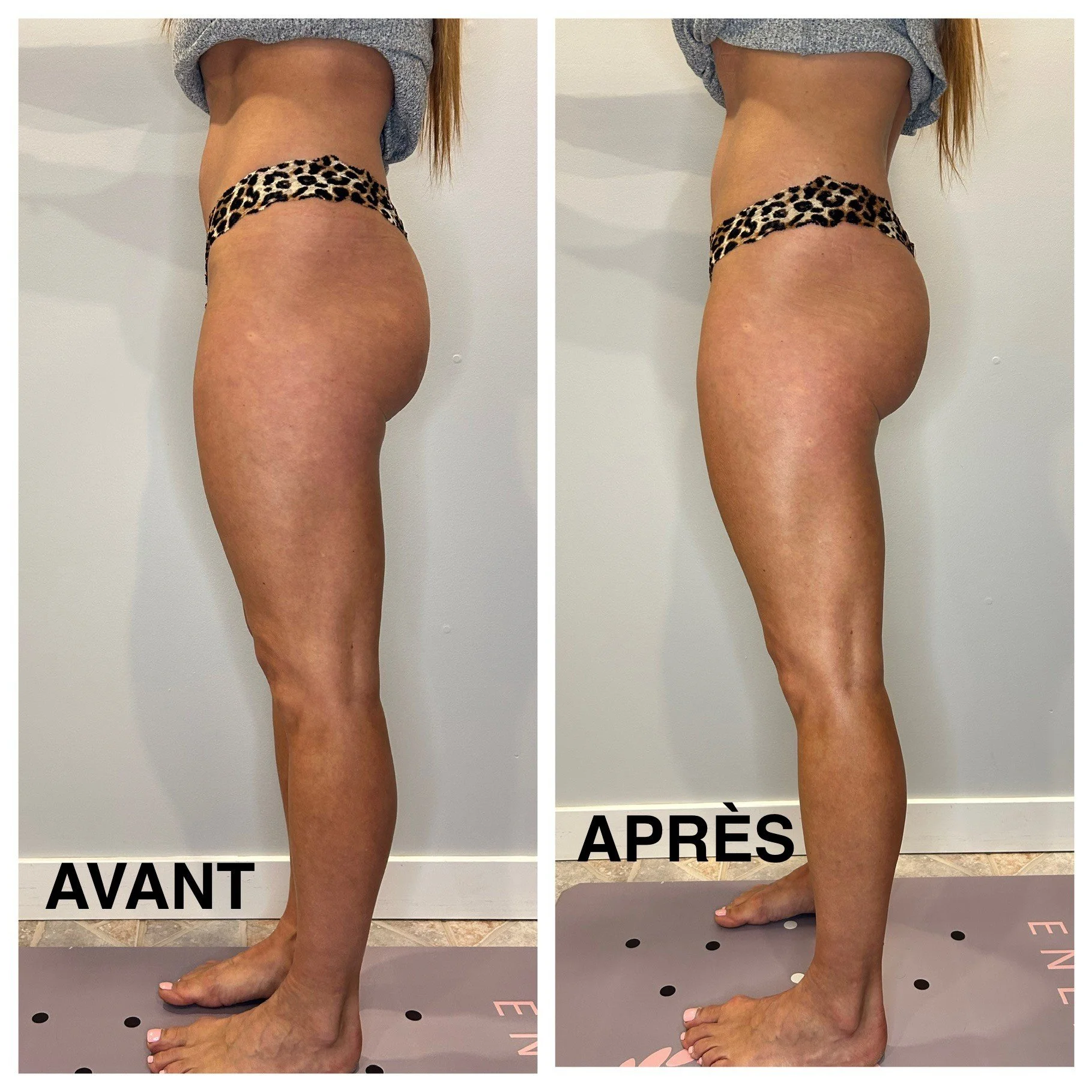 Julie_Remodelage-Fesses-Côté.jpg