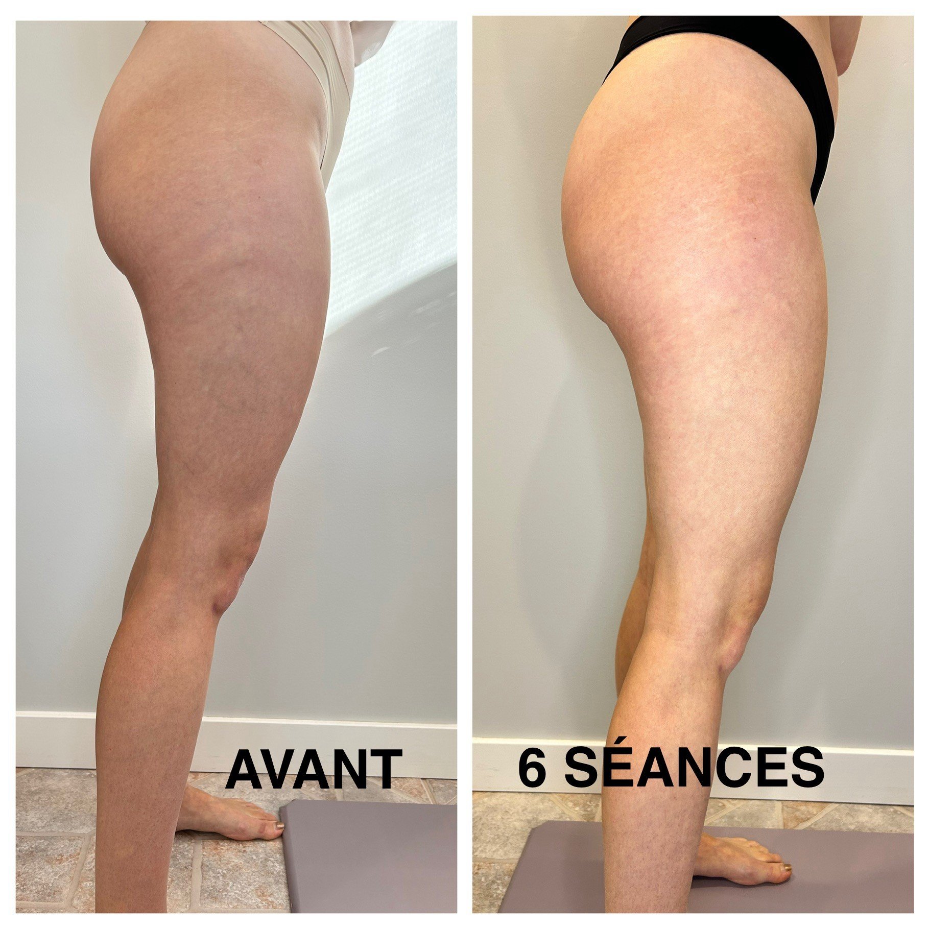 Johany_Jambes_Côté.jpg