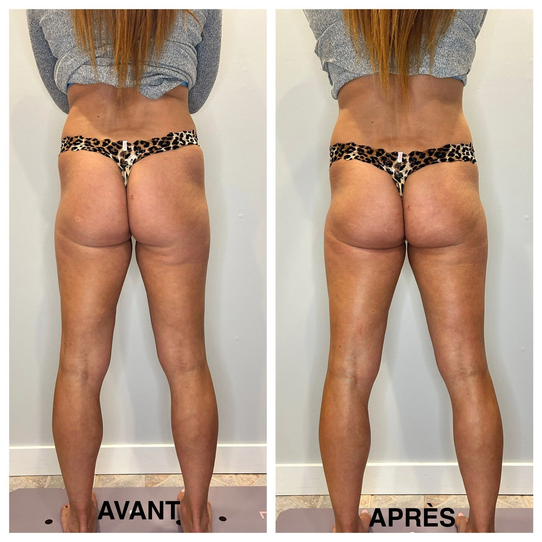 Julie_Remodelage-Fesses-1séance.jpg