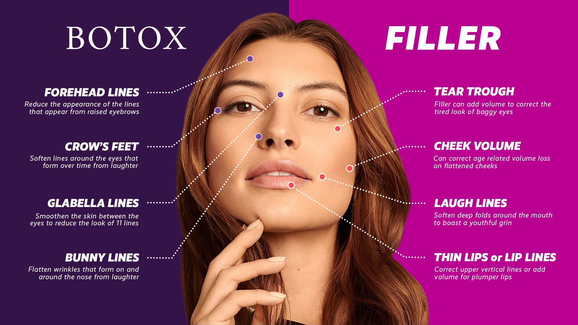 botox-and-filler.jpg