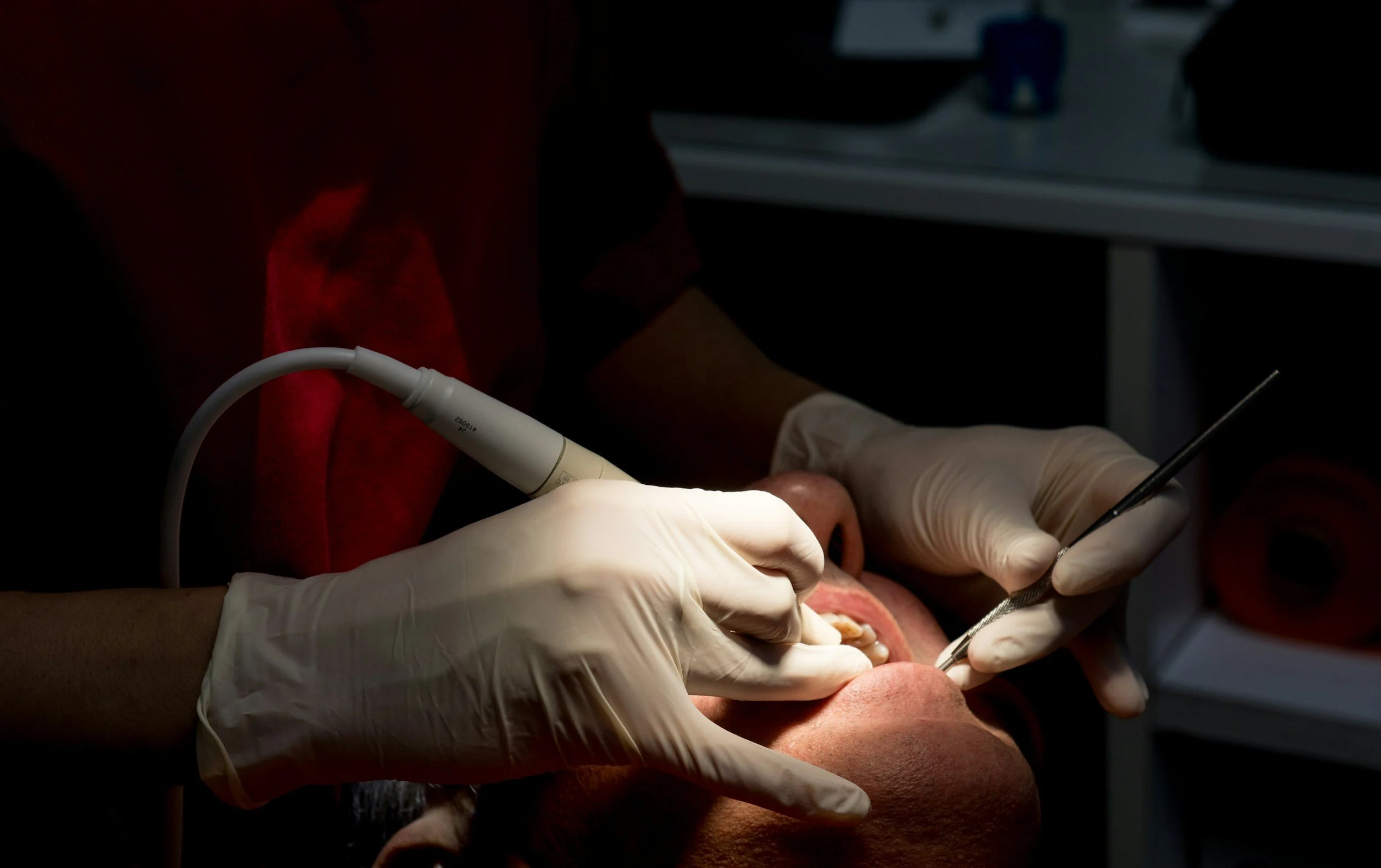 Dentist performing a procedure on a patient's mouth with dental tools and wearing gloves.