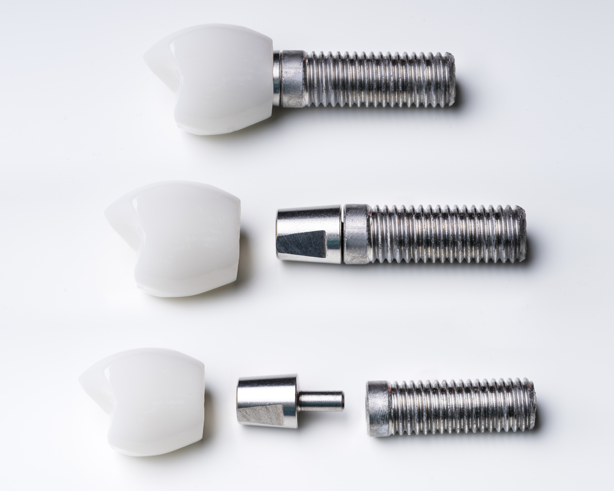 dental implant material birmingham uk