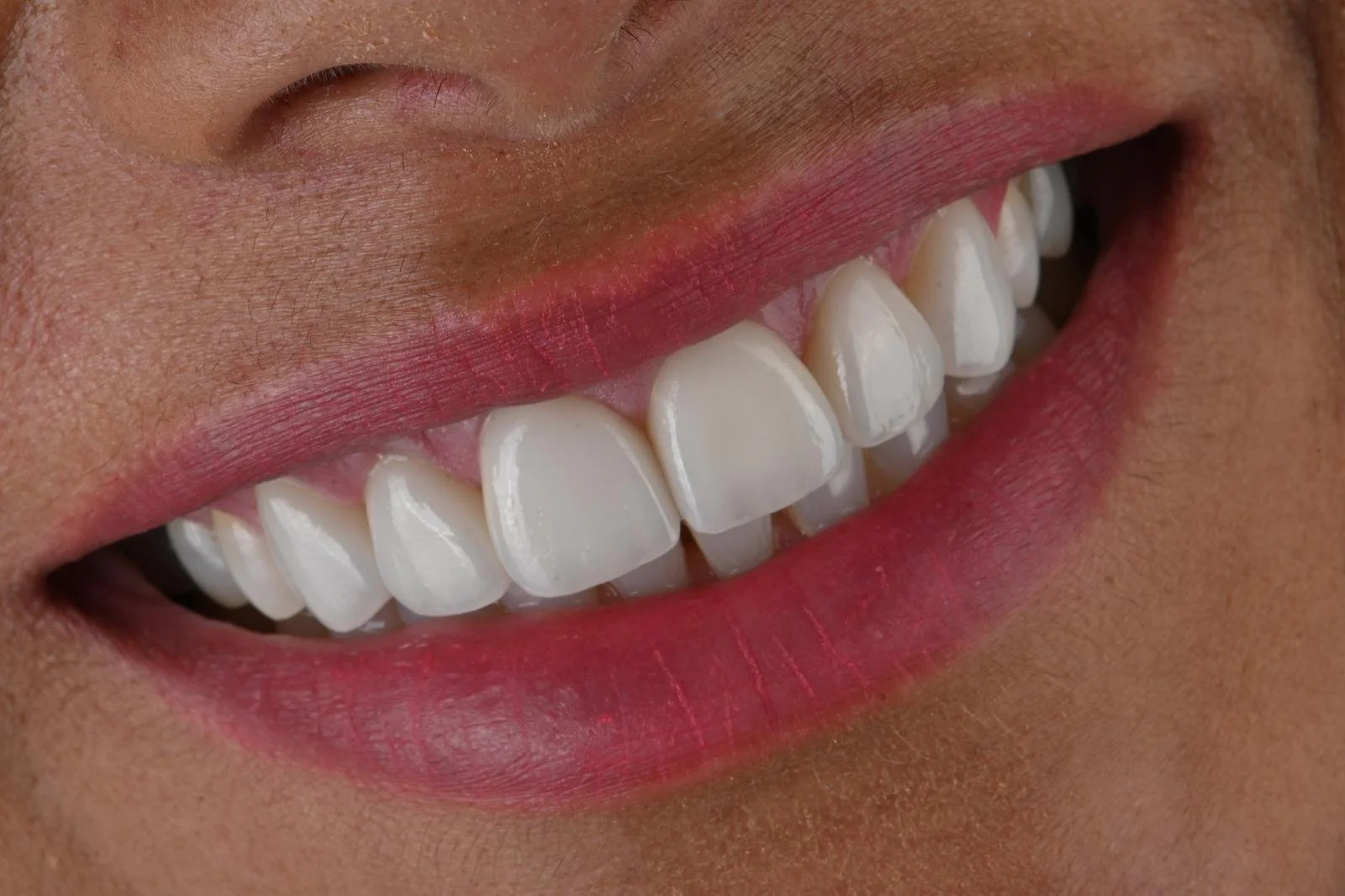 Close-up of a person's bright smile showing white teeth and pink lips.