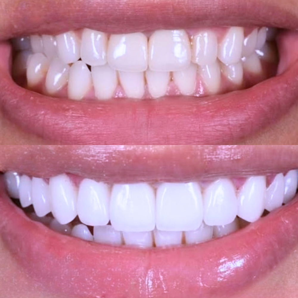 Untitled Design - 10.png