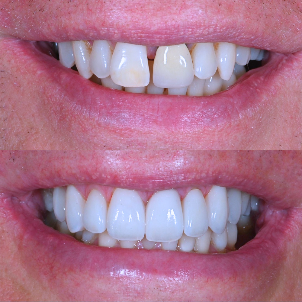 Untitled Design - 8.png