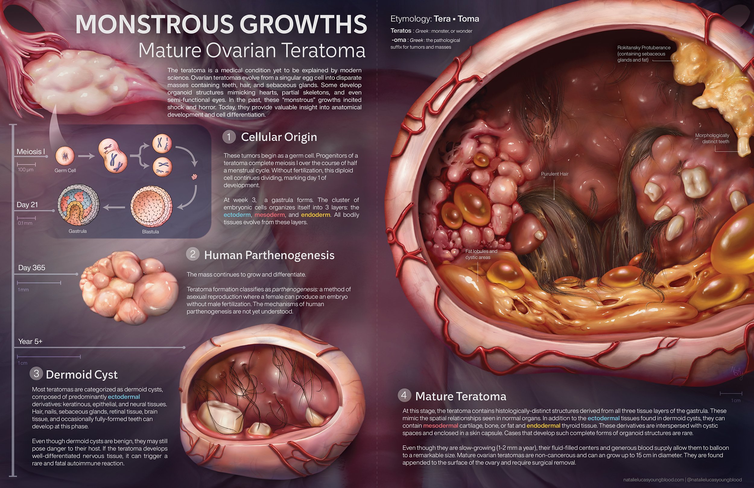 NL_pathology_final_1.jpg