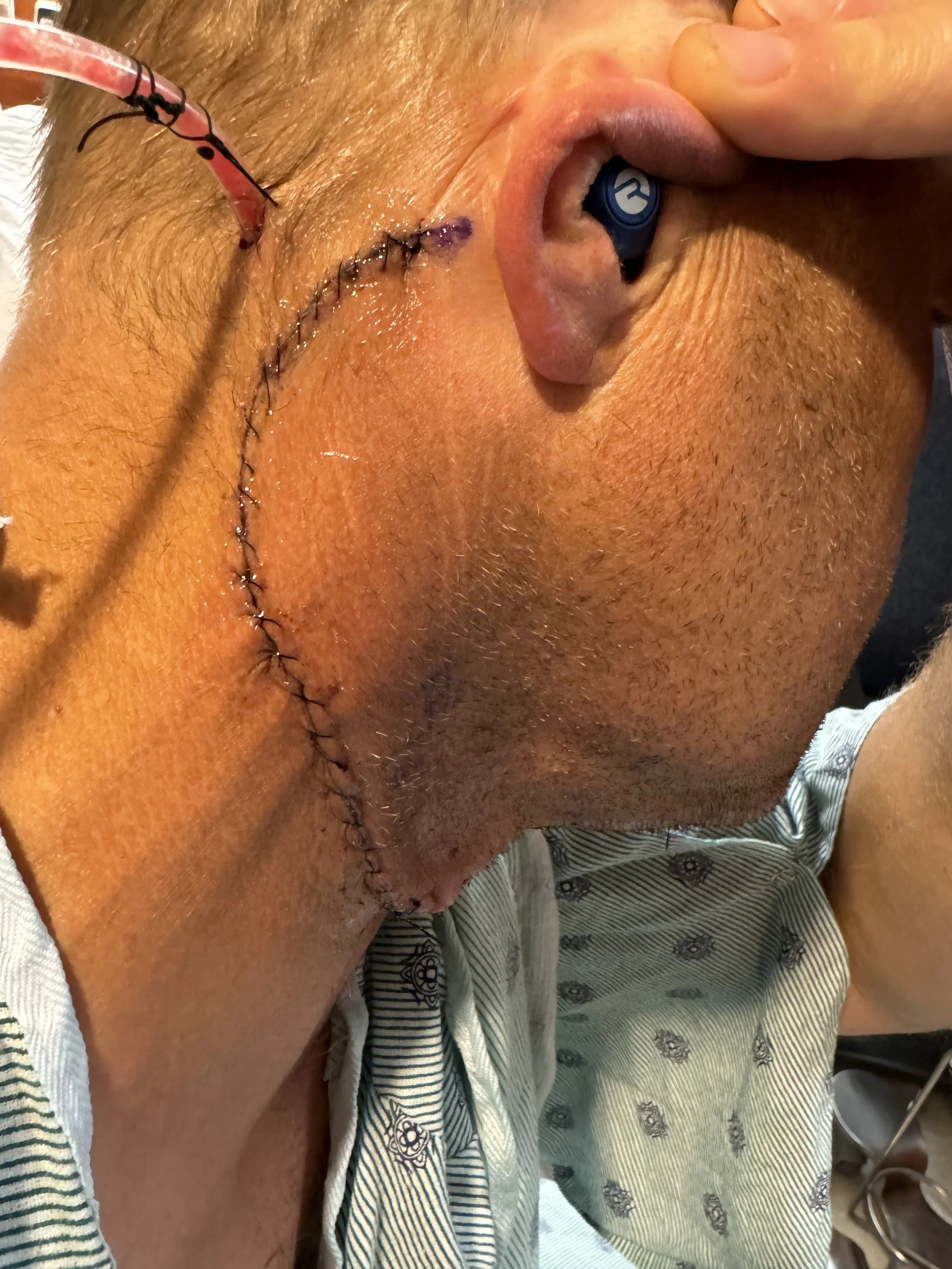 A Caregiver as Patient