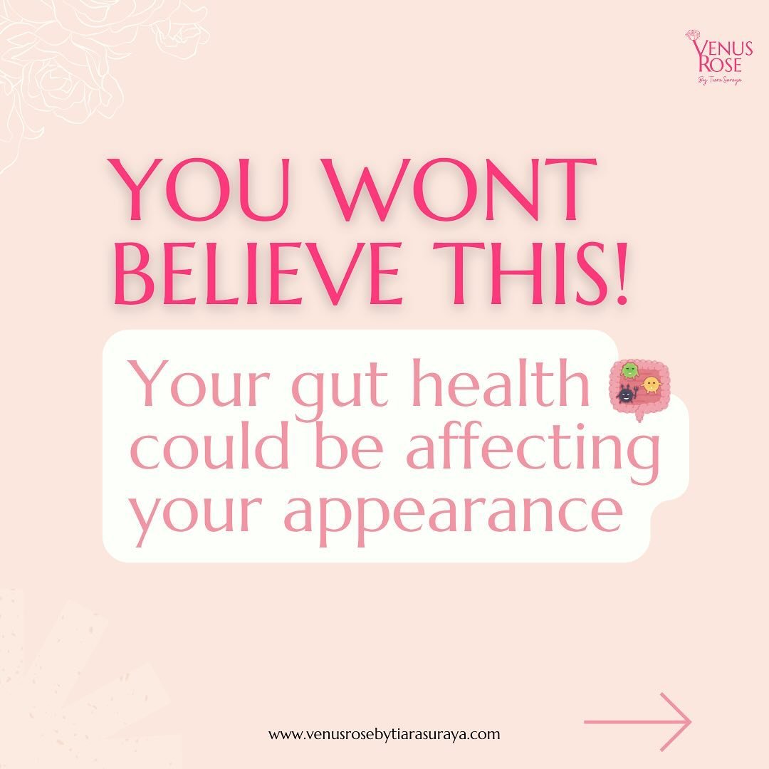 Get Rid of Feeling Tired, Bad Skin, and Hard Time Losing Weight, and it&rsquo;s Time to Unleash Your Inner Glow ✨

Your gut might be the secret culprit behind your appearance struggles.

🌹 Experience skin glow-up and newfound energy!
🌟 Bid farewell