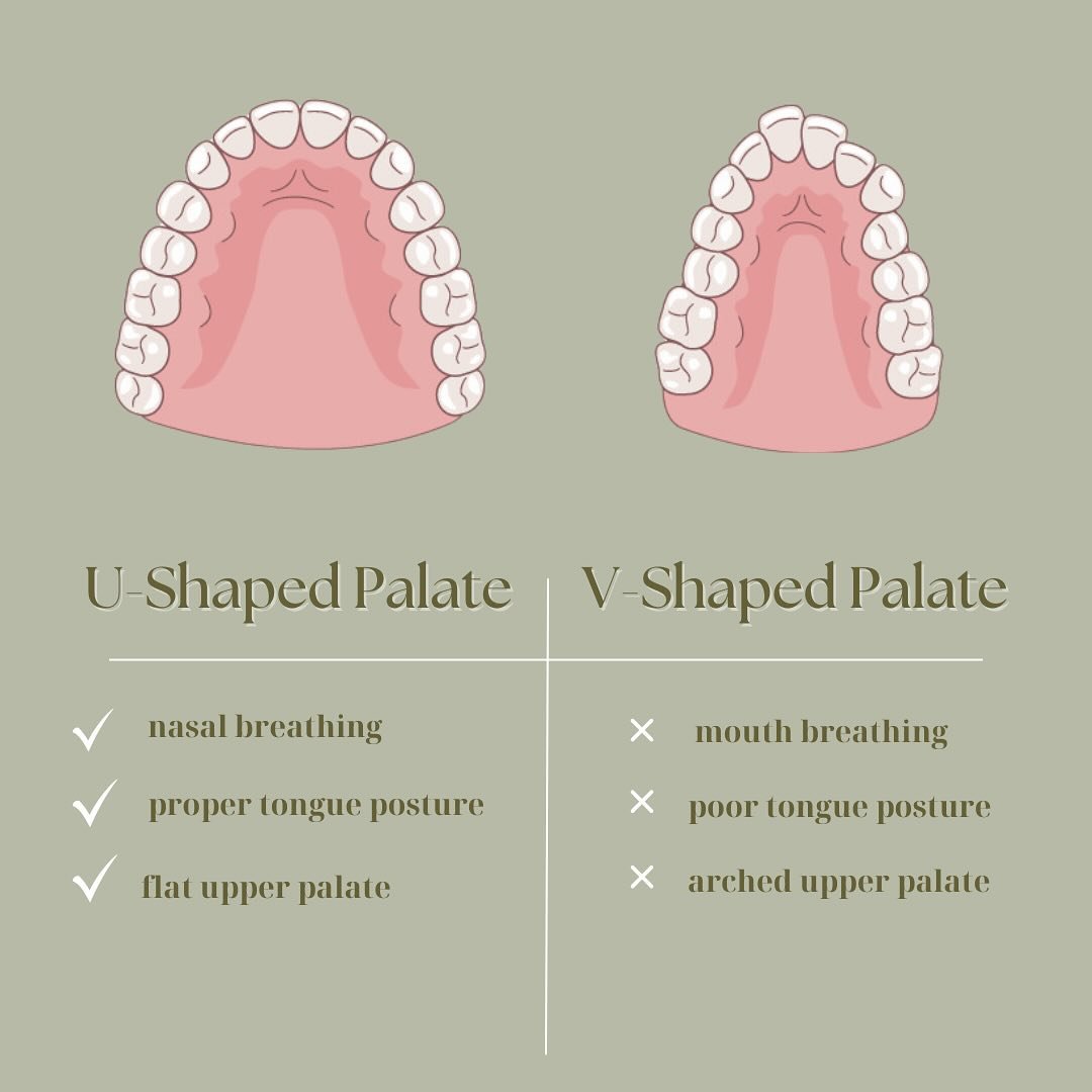 We can tell if your nose breathing 👀 

We know if you are nose breathing and where your tongue sits at rest just by looking at your mouth! How? Easy! 

If you naturally sit with your tongue suctioned to the roof of your mouth (as you should) then yo