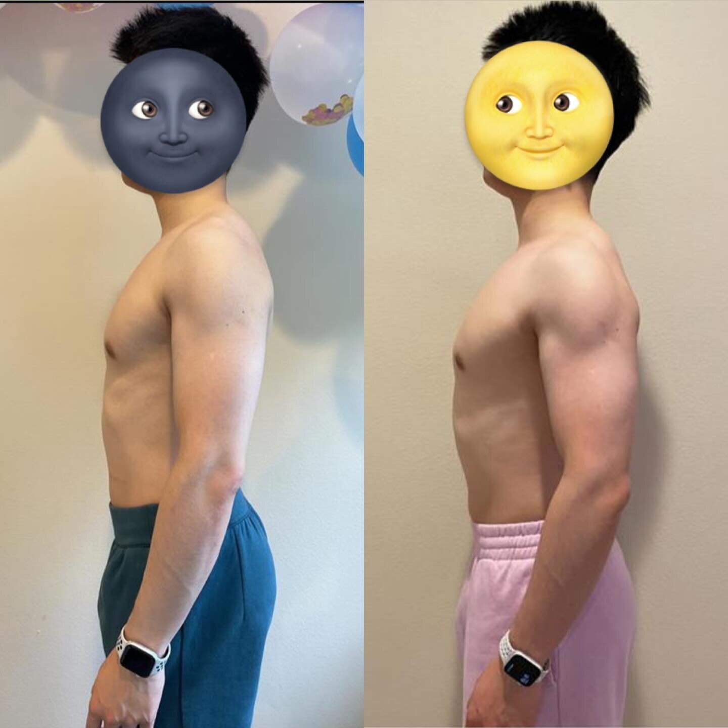 Online coaching client Zhenghe gained 5 lbs of muscle in the last 4 months, and improved his strength levels drastically. And as you can see, this was not a dirty bulk, his body fat level stayed about the same, only with visibly more muscle mass in t