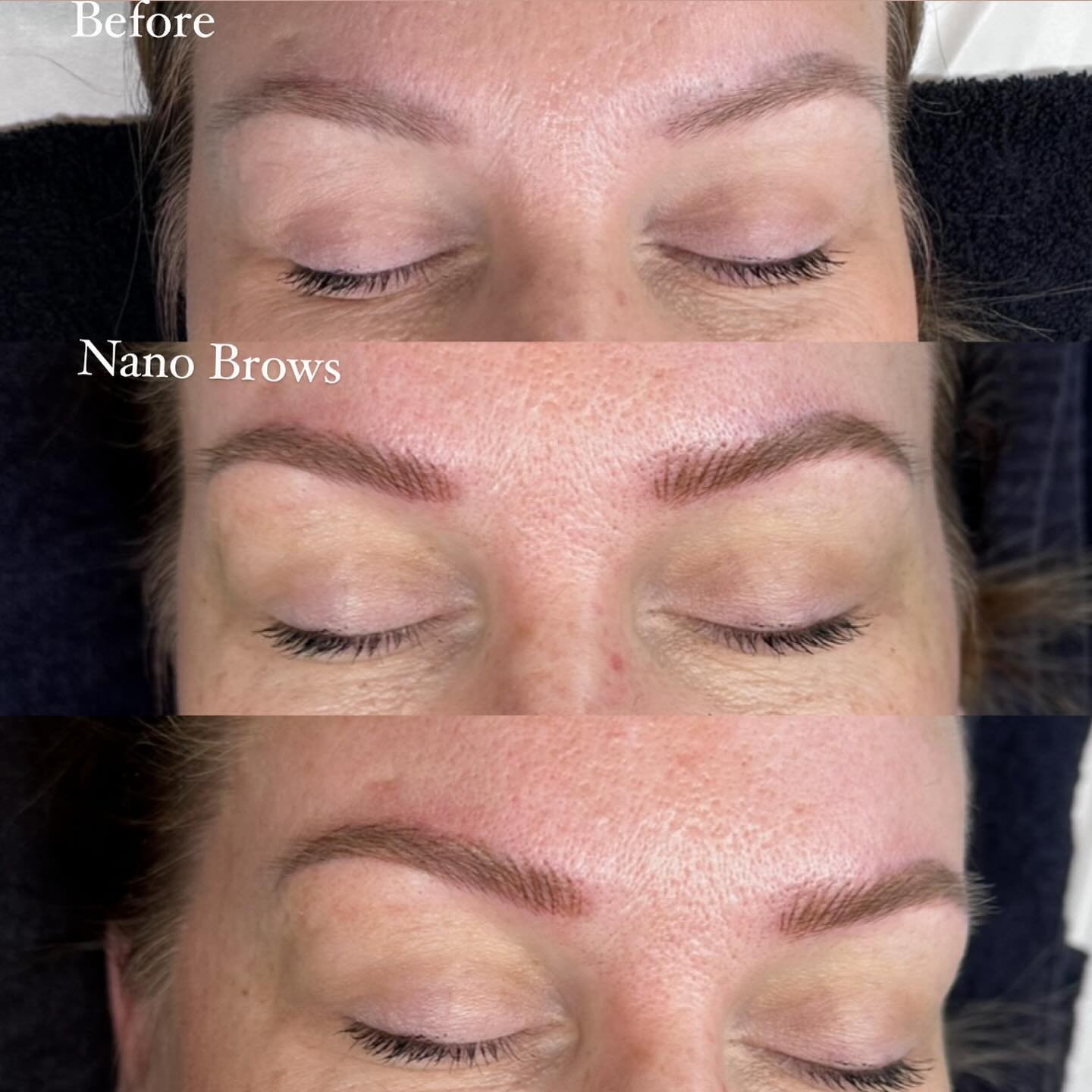 My beautiful client came in a bit skeptical with an old faded work; she was concerned of the outcome of nano over her previous work! 

She left extremely happy with her new #nanopowdercombobrows 💫🪄