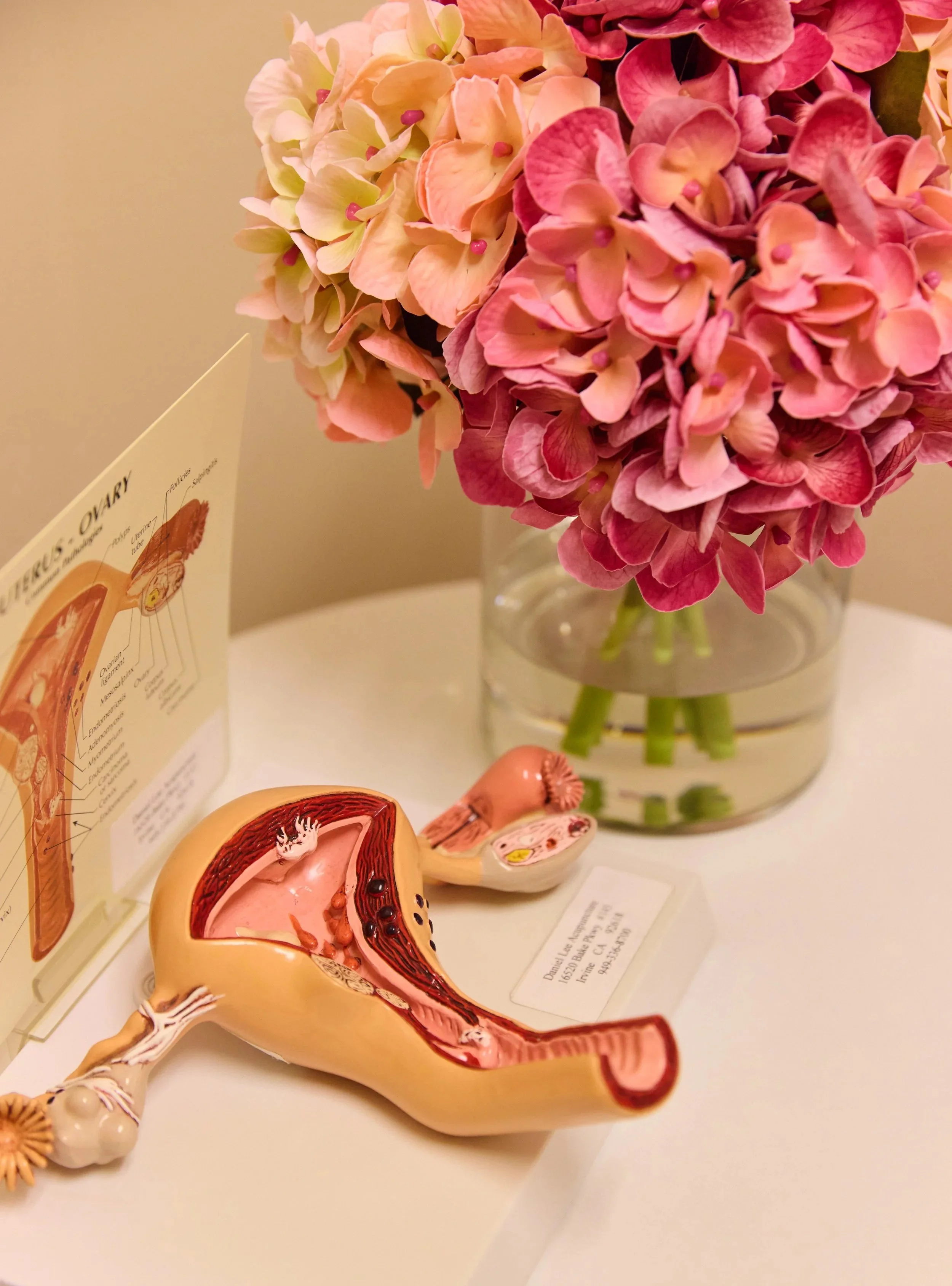 Uterus model to explain IVF, IUI, and FET support acupuncture in Irvine, Orange County