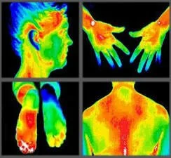 Thermography Screening