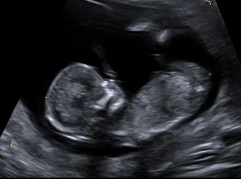 12 Weeks Pregnant - the first ultrasound!