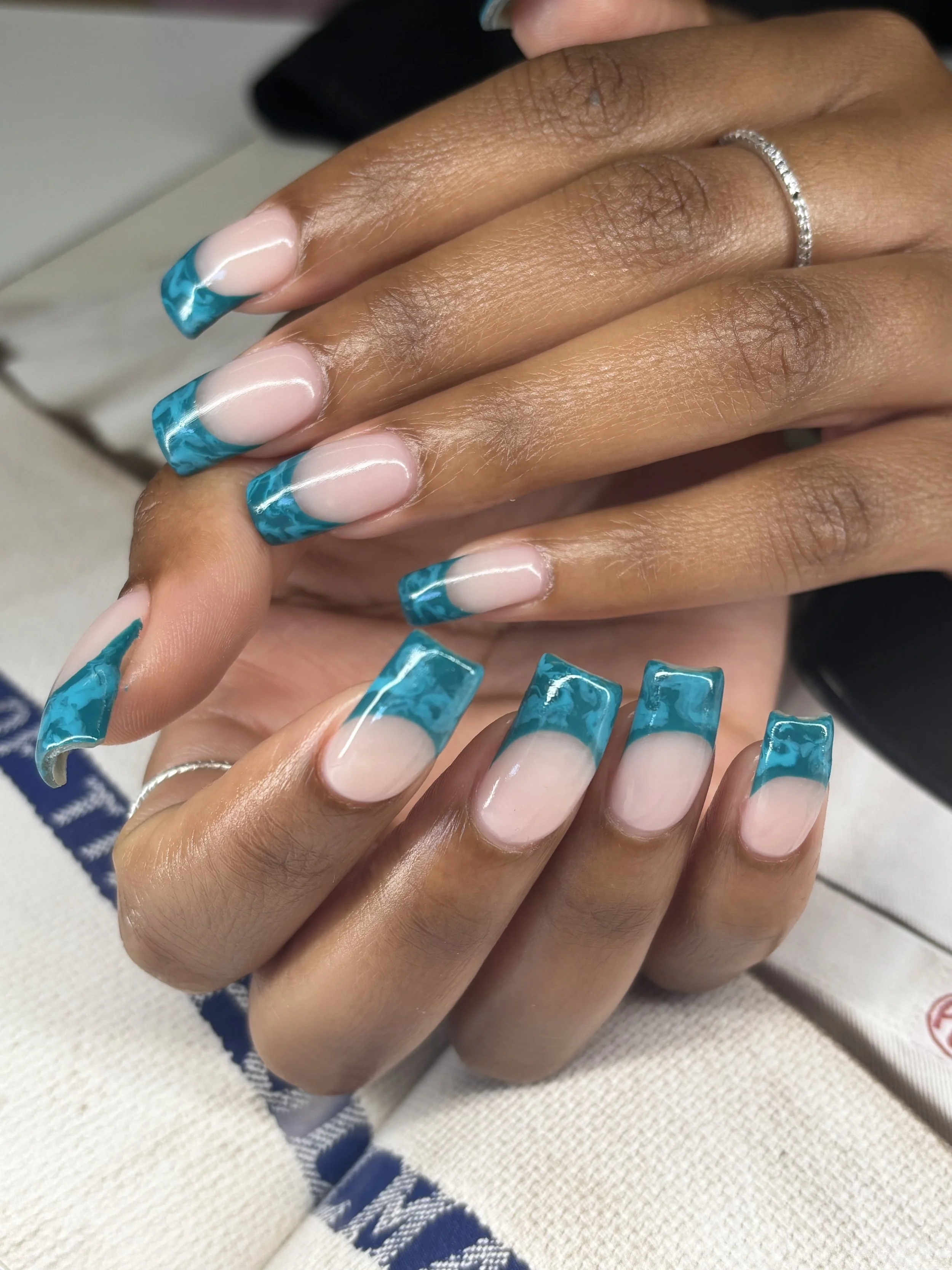 TIPS 312 abstract french tips