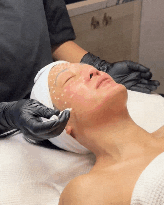 Studio Varuni Liquid Microneedling