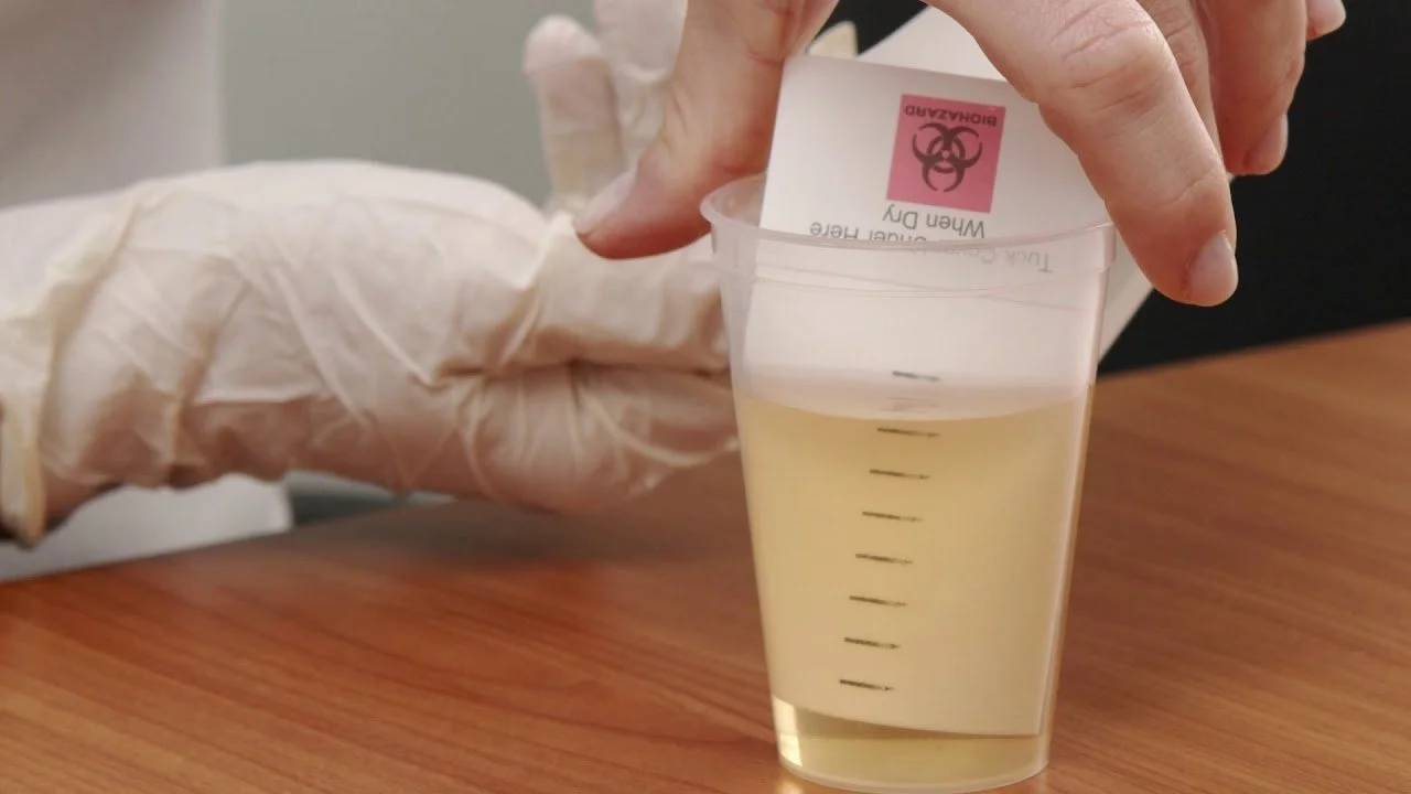 Completing DUTCH hormone testing through Nutripath