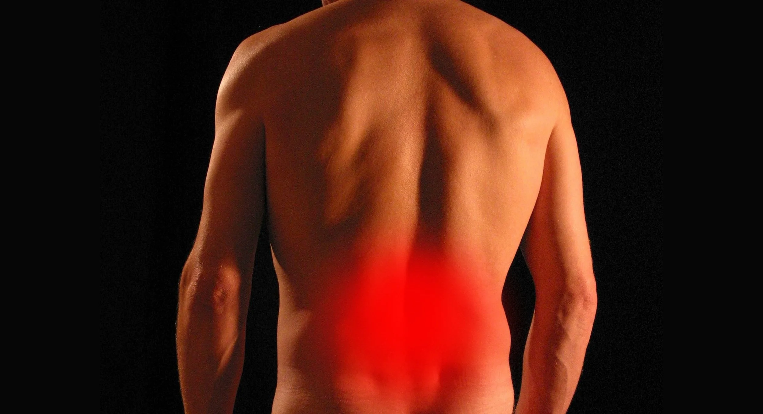 Sciatica Treatment in San Jose, CA | Sciatic Nerve Pain Relief