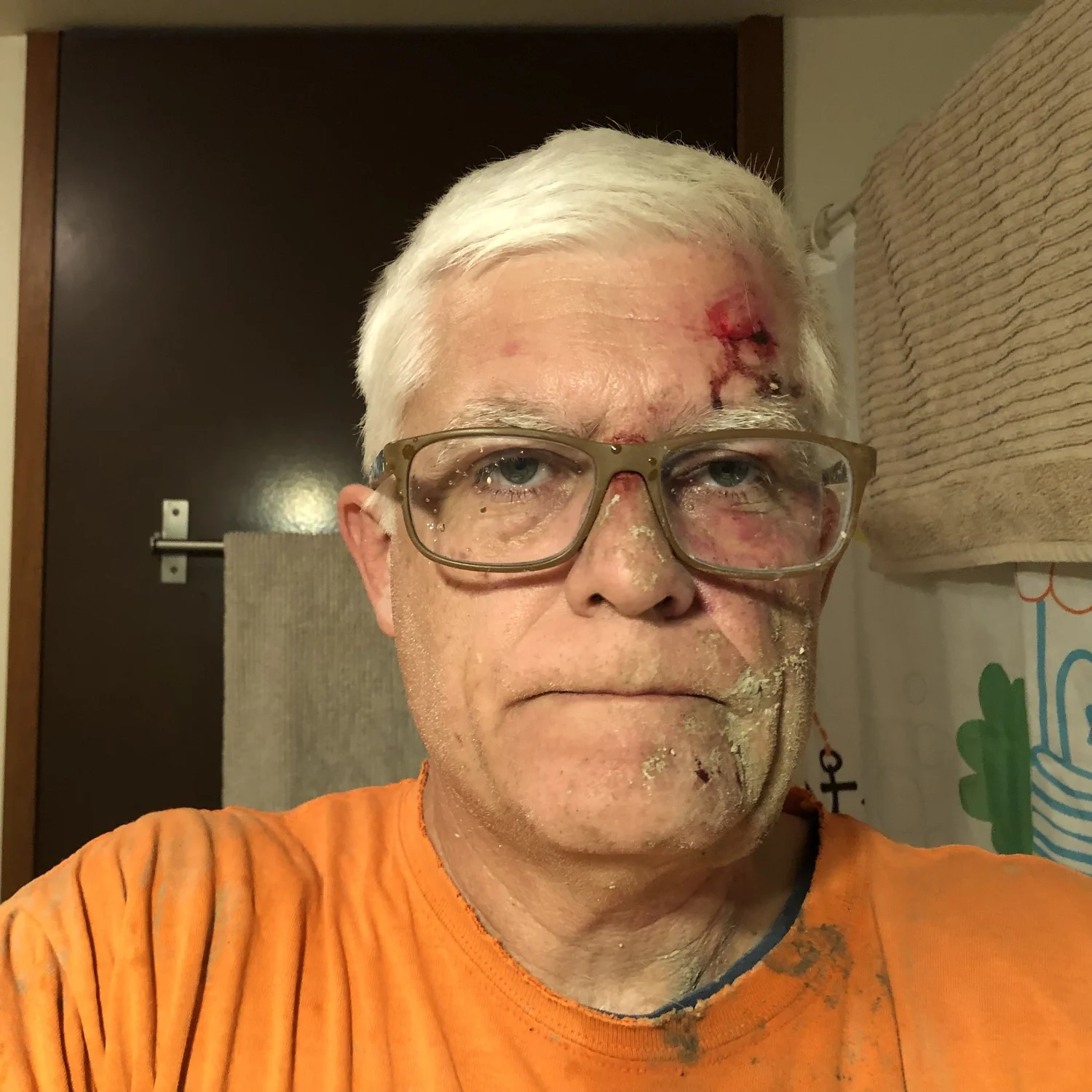 Pedal Power member David after his cycling crash