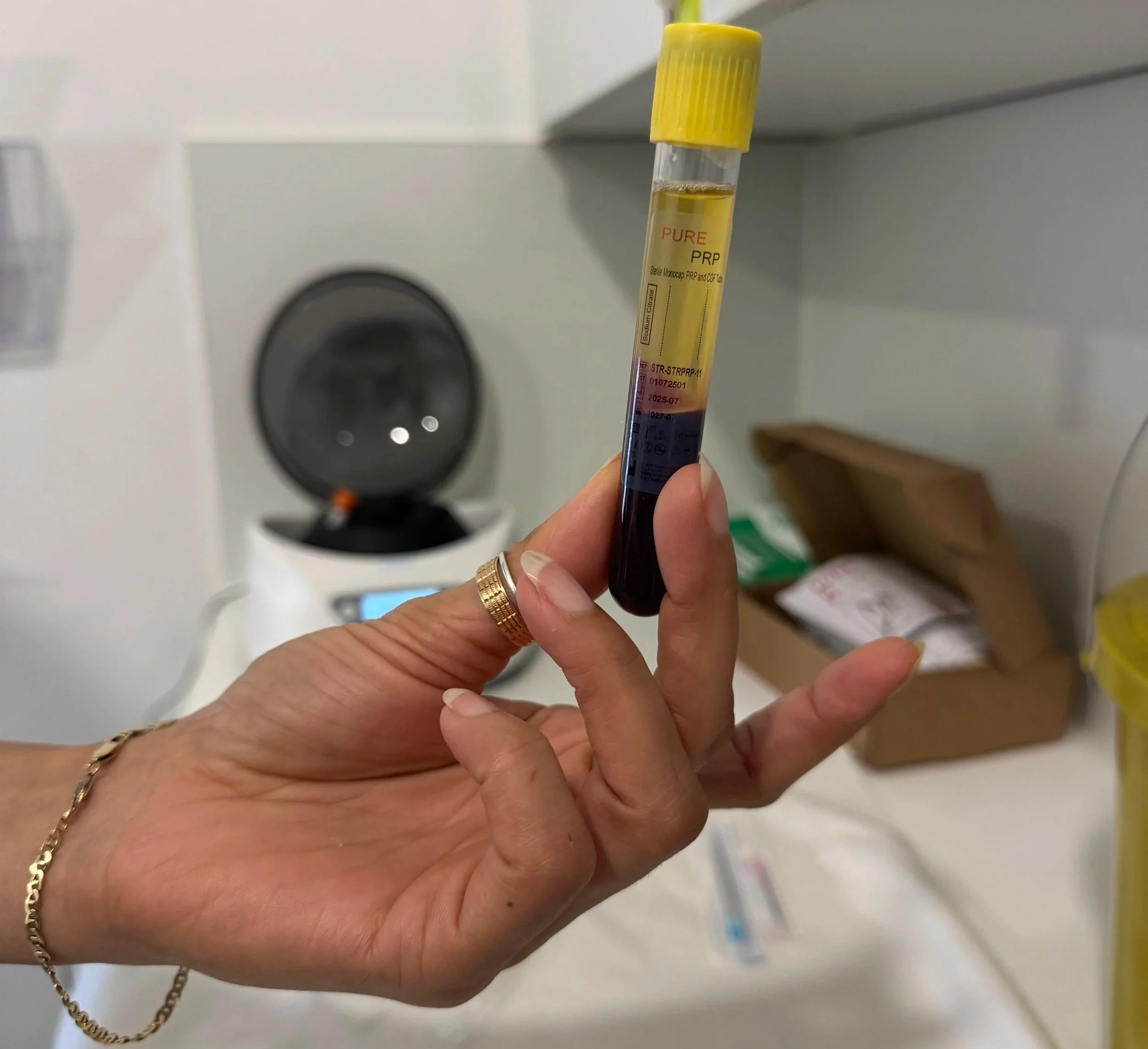 Does PRP Work for Hair Loss? What to Expect from Treatment in Birmingham