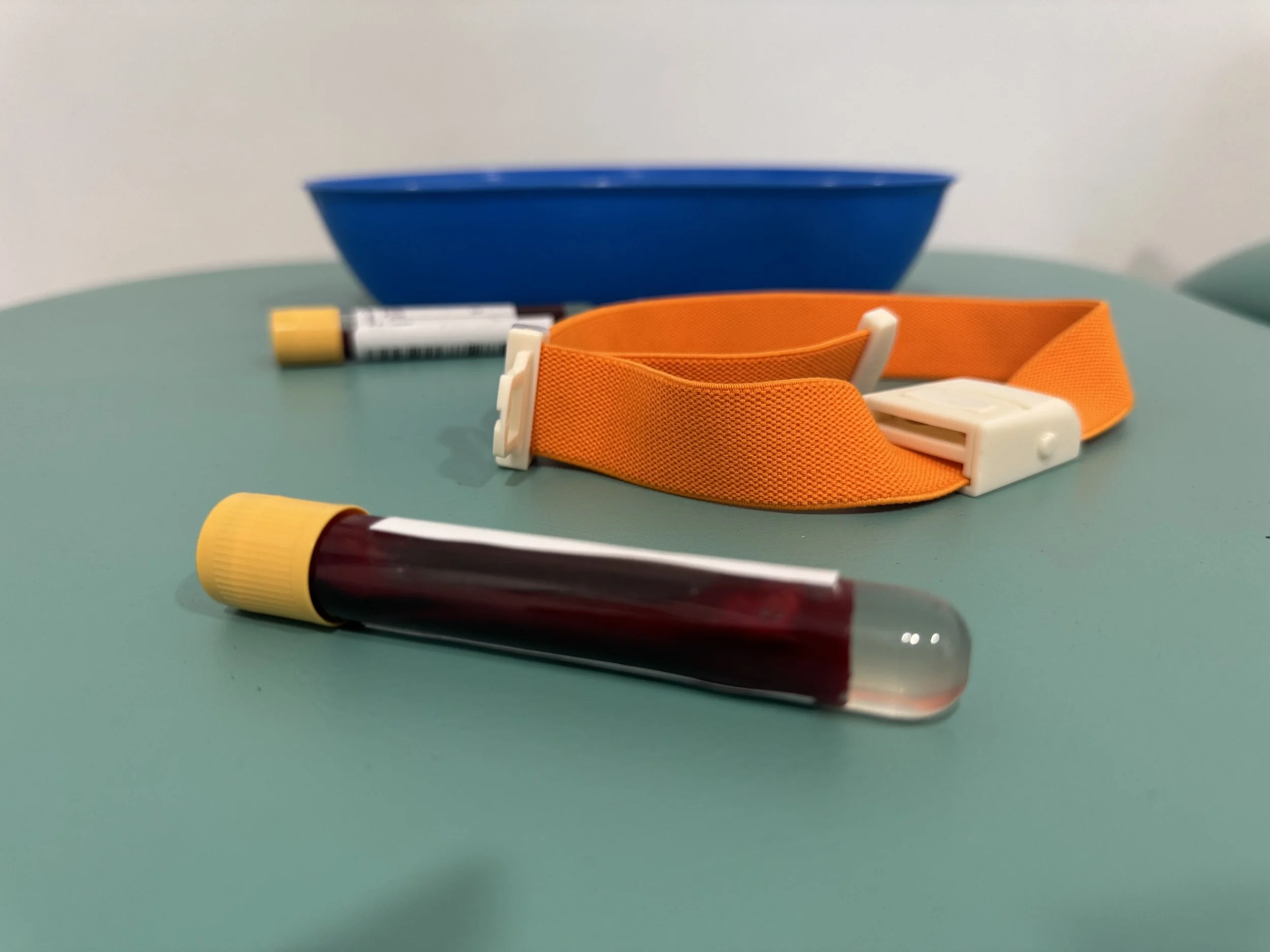 Close-up of a blood sample tube with a yellow cap, a blue bowl, and an orange strap with white clips on a green surface.