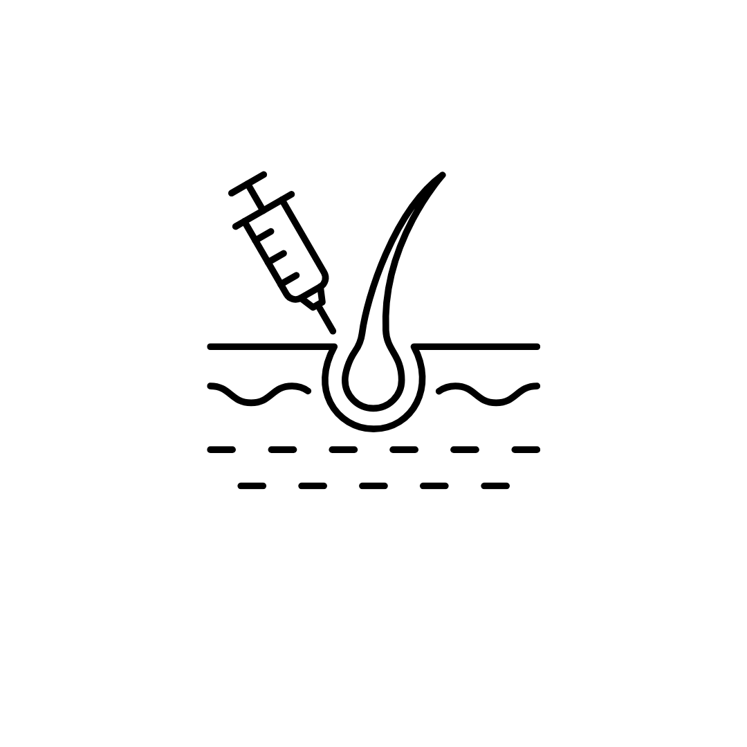 Diagram of a scalp with a hair follicle, showing a syringe injecting into the scalp.