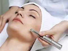Professional microneedling facial treatment