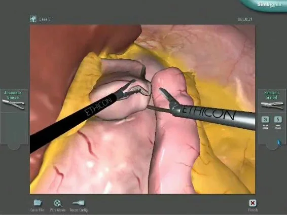 LAP-Gastro-Gastrojejunal_Anastomosis_Video.jpg