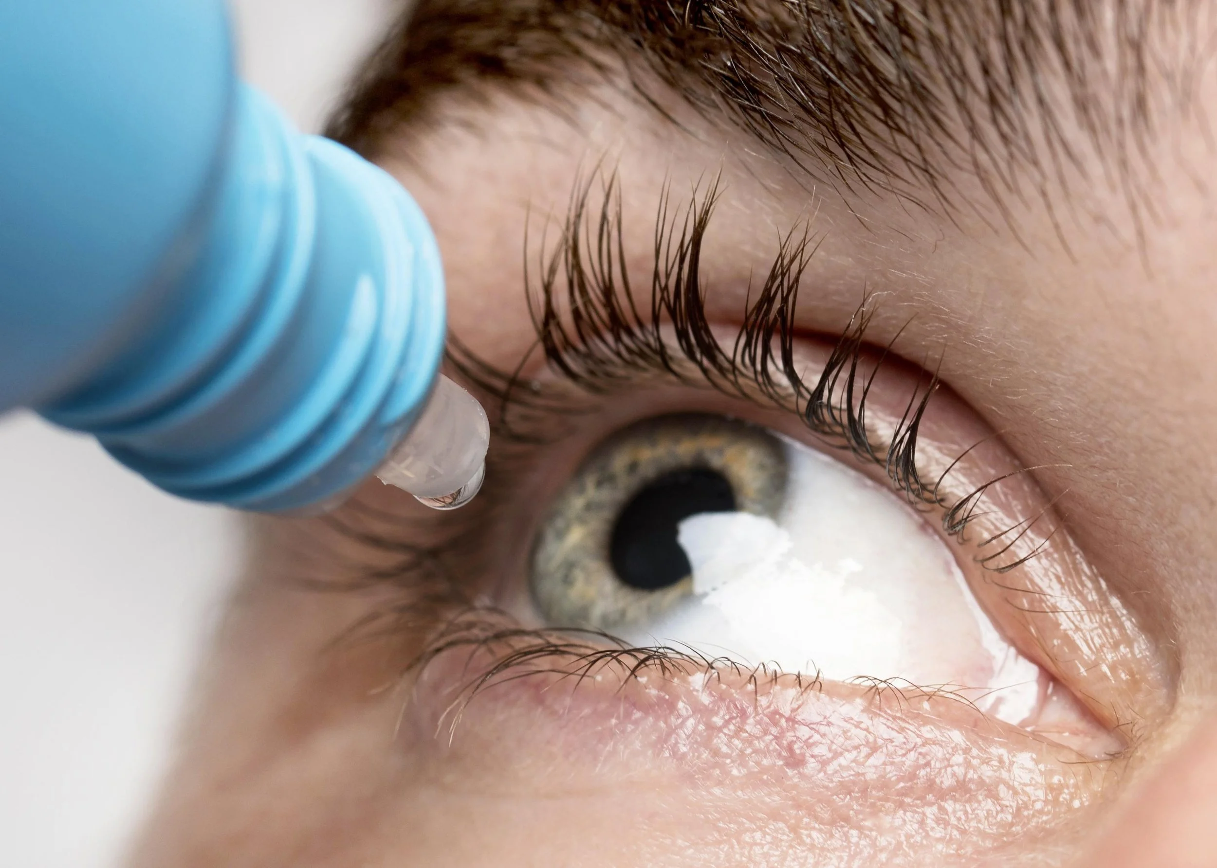 Close-up of a person's eye with a dropper applying a liquid medication or eye solution to the eye | Dr. Robert Meade | Public Speaker & Vision Consultant | Presentations about Eyes and Vision