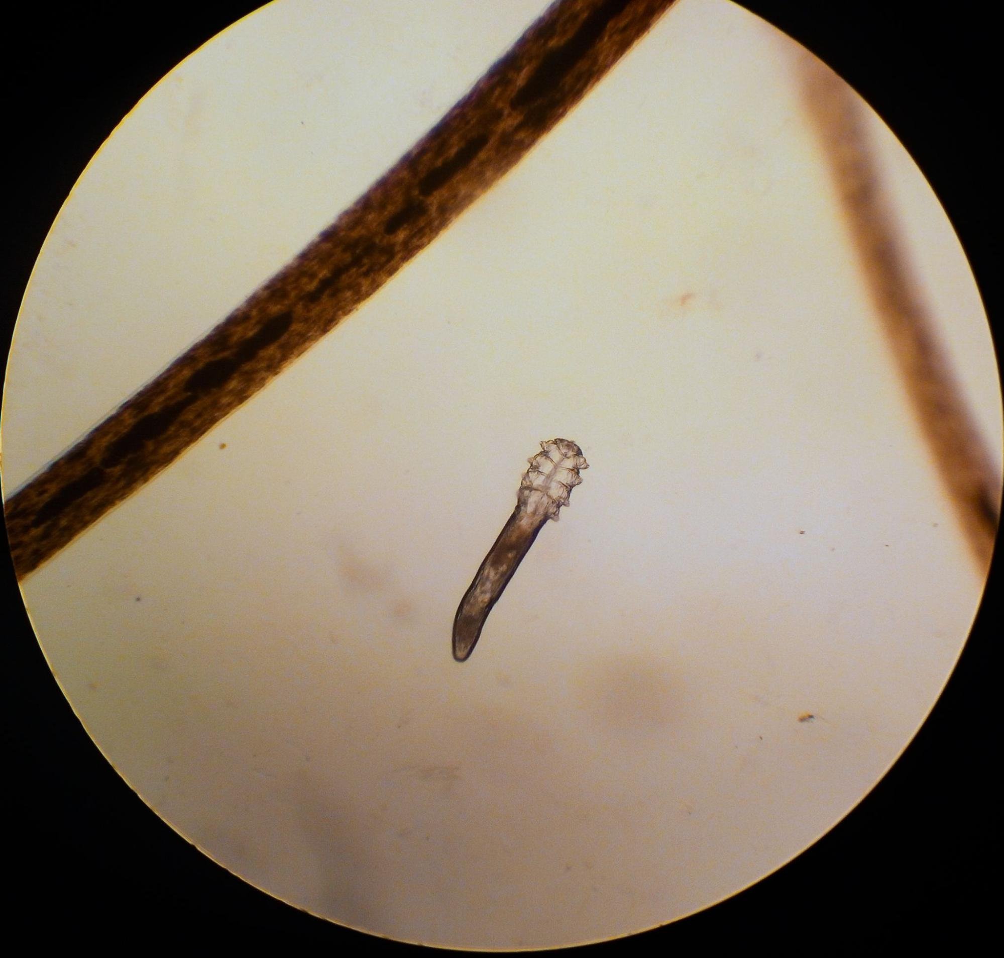 Demodex mite next to an eyelash under a microscope